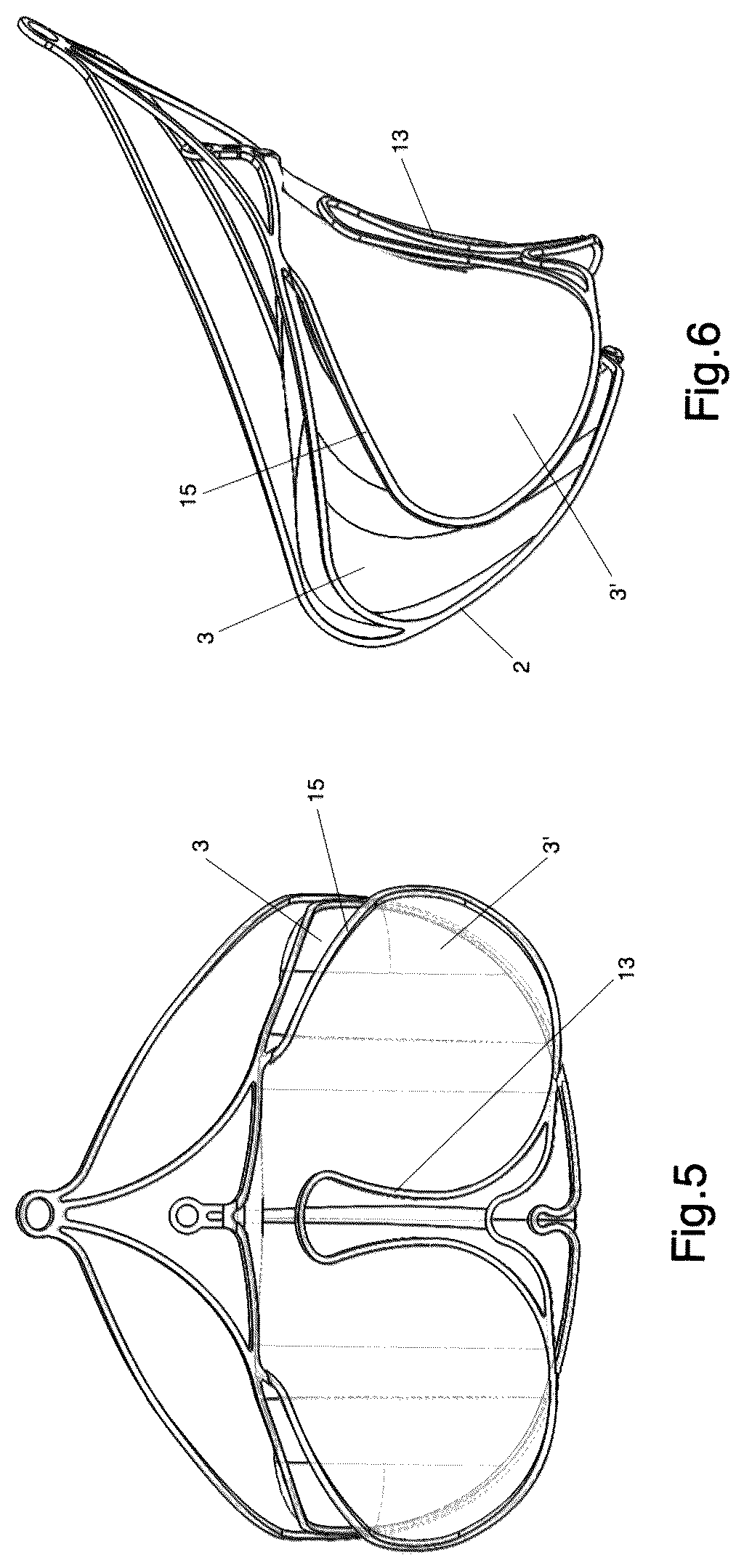 Patent US12303387 Figure 3 – Implant for improving coaptation of an atrioventricular valve