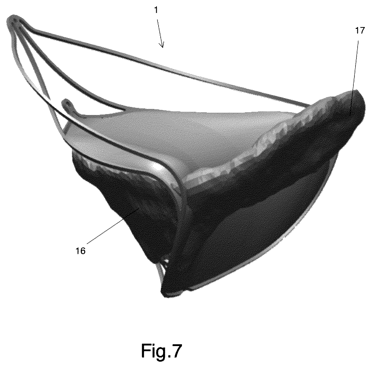 Patent US12303387 Figure 4 – Implant for improving coaptation of an atrioventricular valve