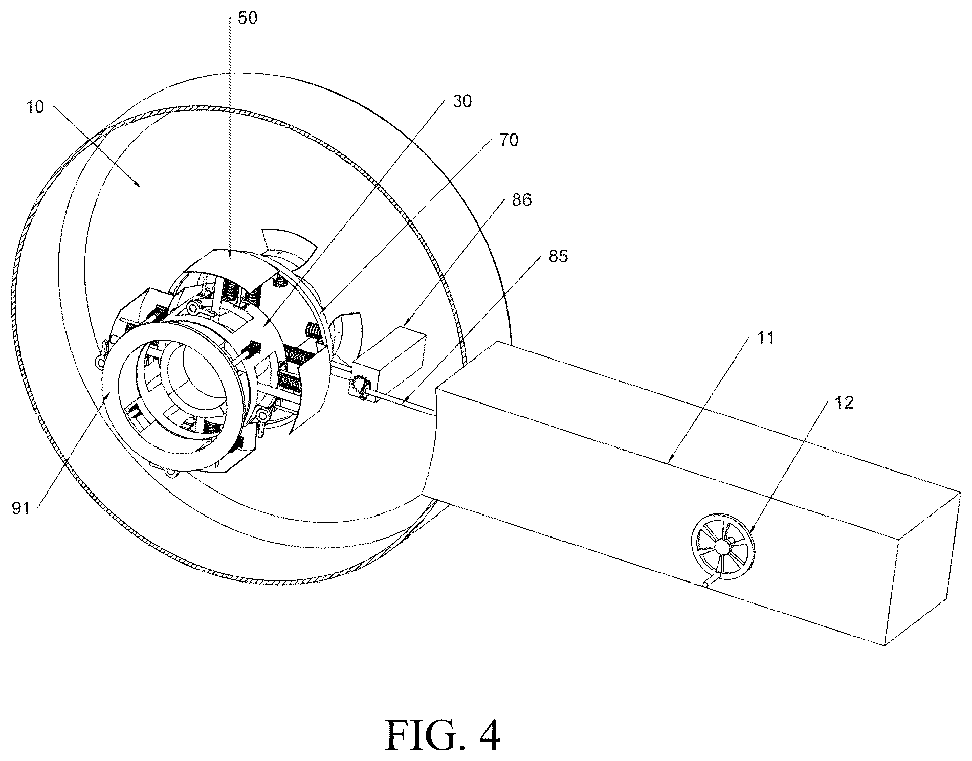 Patent US12303388 Figure 4 – Valve compression apparatus