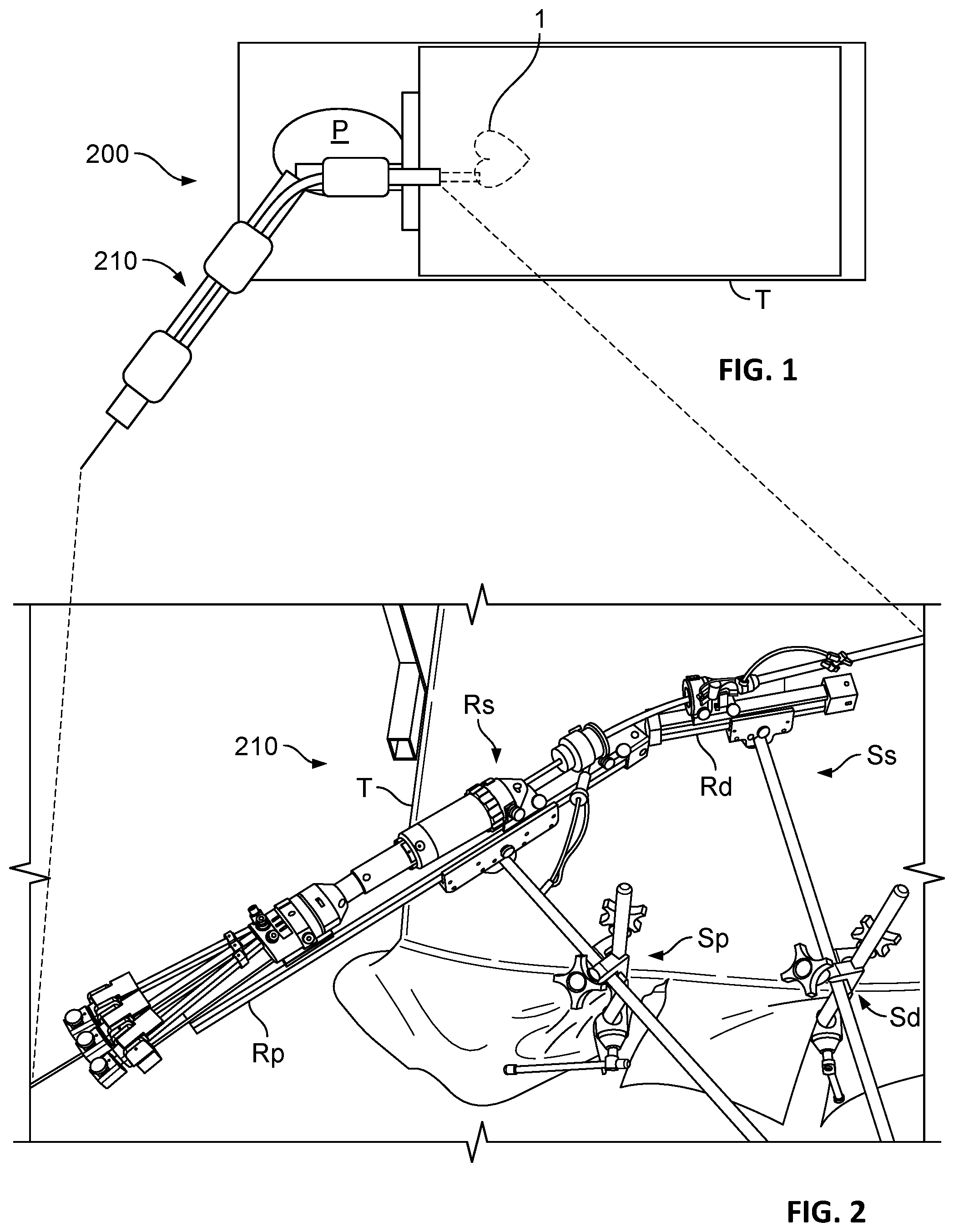 Patent US12303389 Figure 1 – Prosthetic heart valves