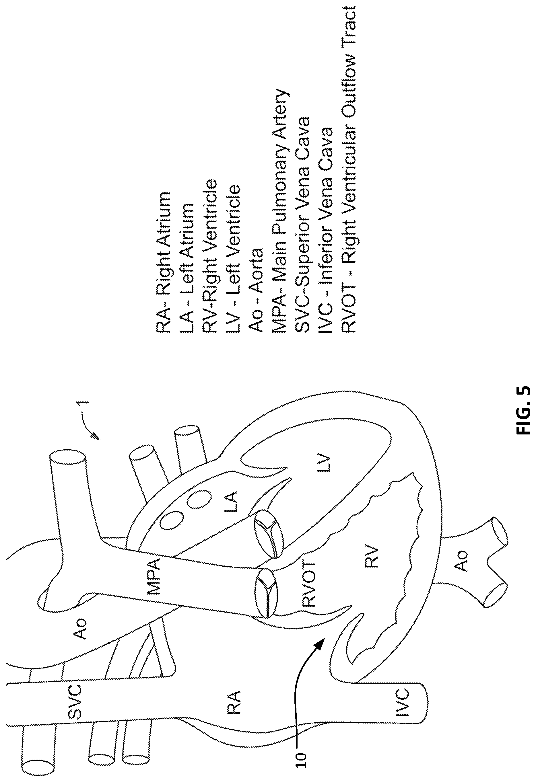 Patent US12303389 Figure 3 – Prosthetic heart valves