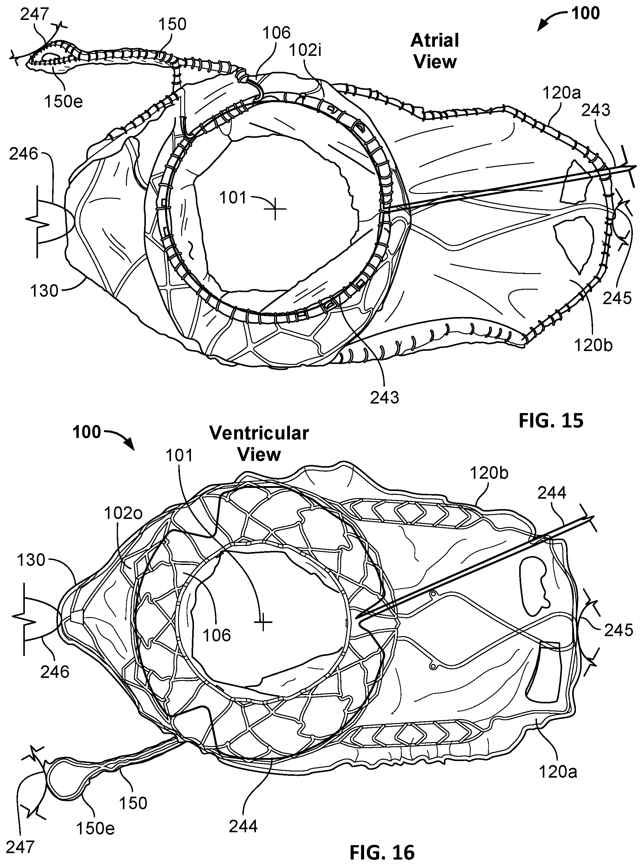 Patent US12303389 Figure 8 – Prosthetic heart valves