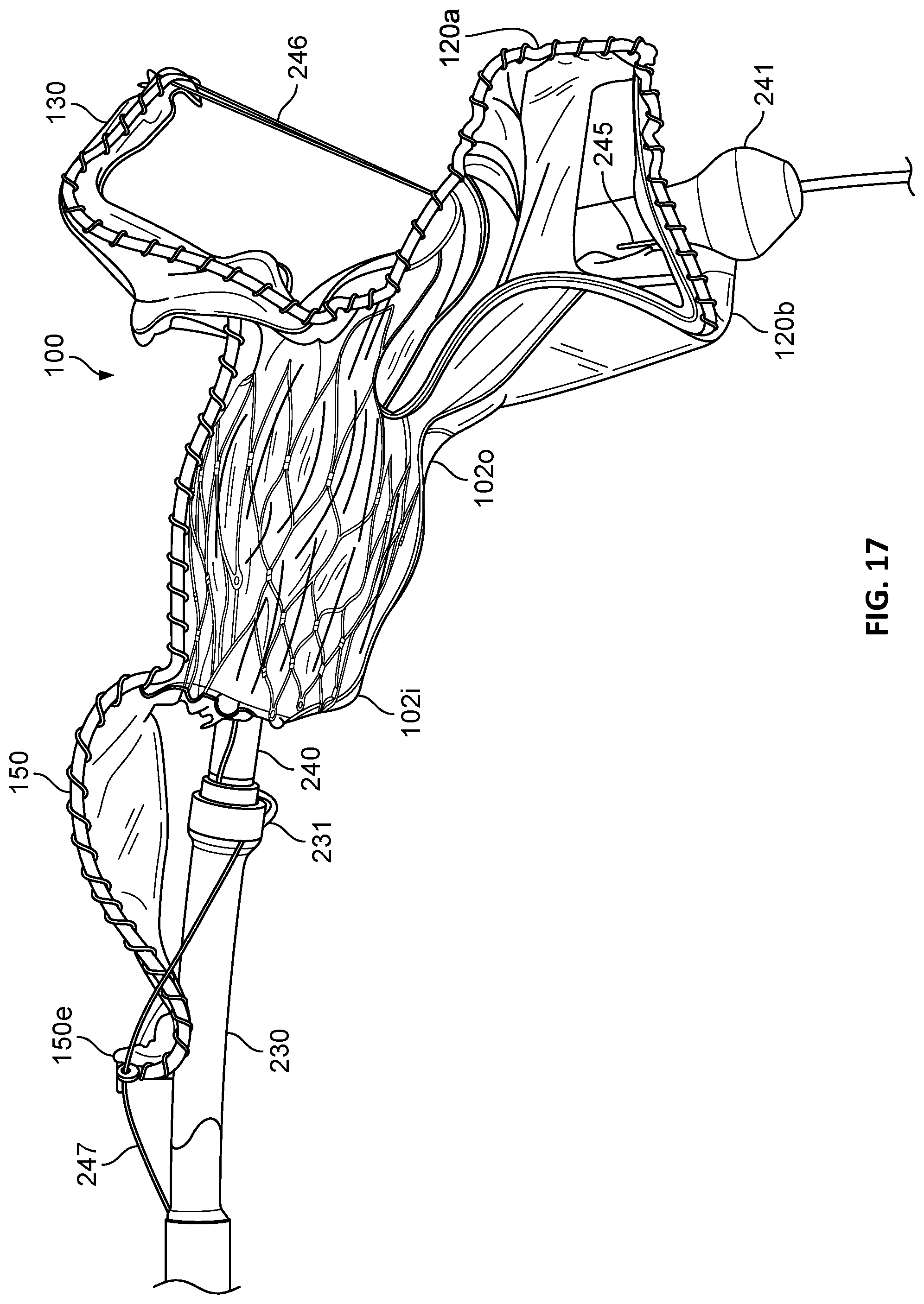 Patent US12303389 Figure 9 – Prosthetic heart valves