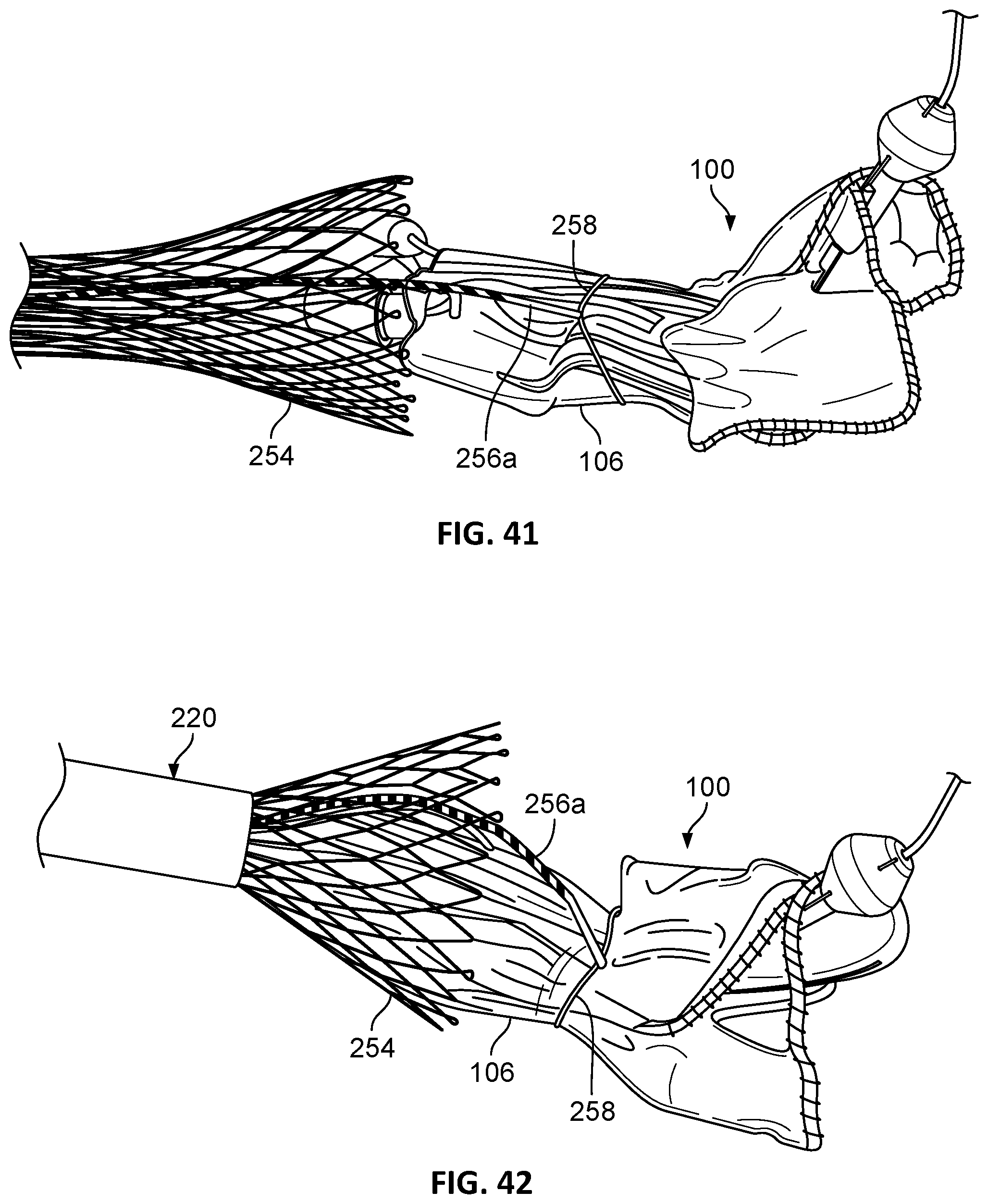 Patent US12303389 Figure 20 – Prosthetic heart valves