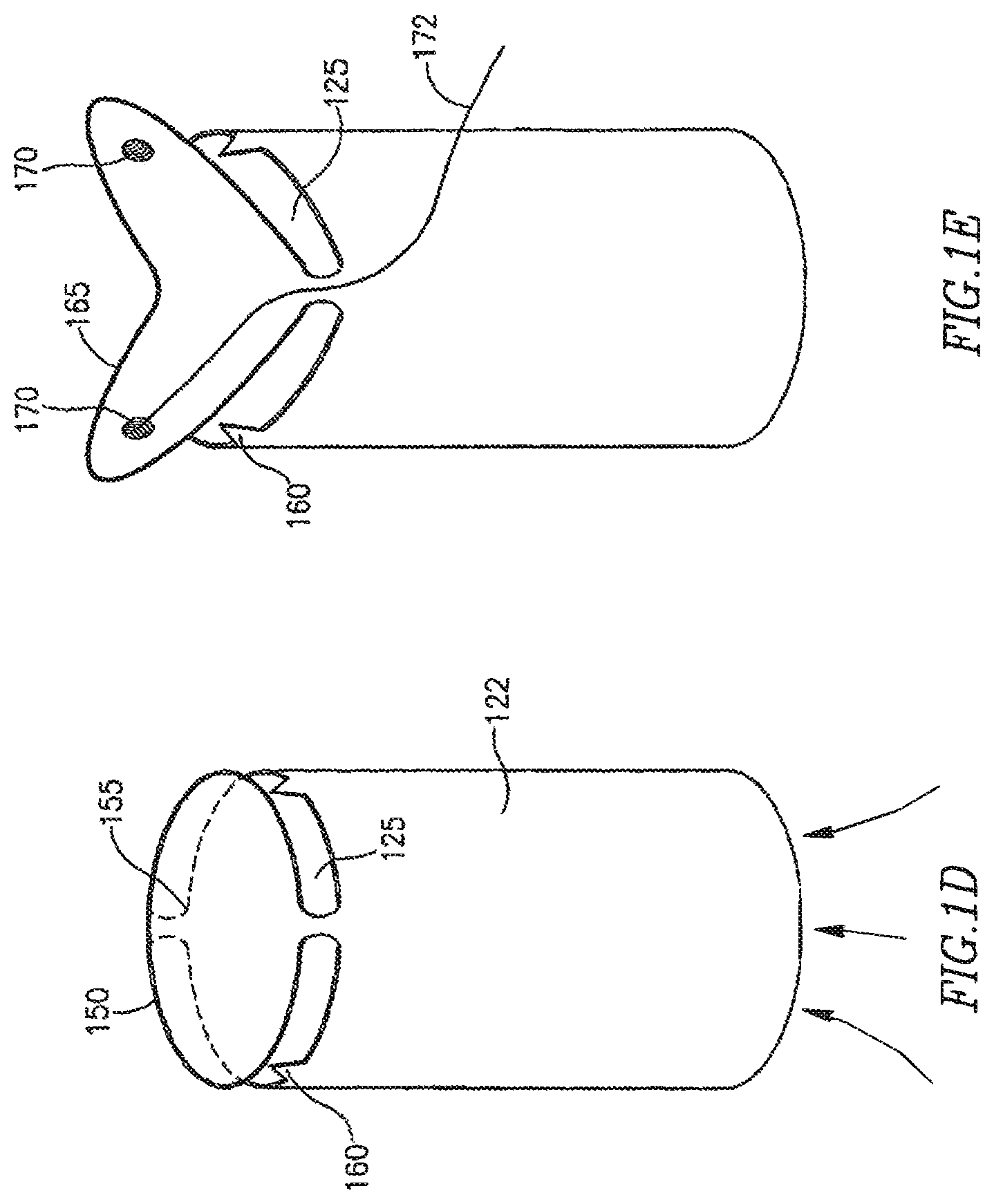 Patent US12303390 Figure 3 – Device and method for controlling in-vivo pressure