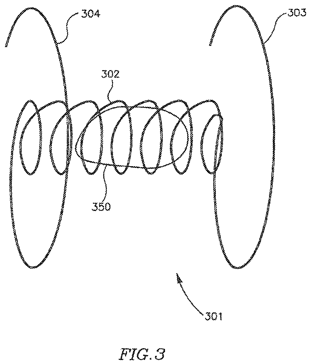 Patent US12303390 Figure 8 – Device and method for controlling in-vivo pressure