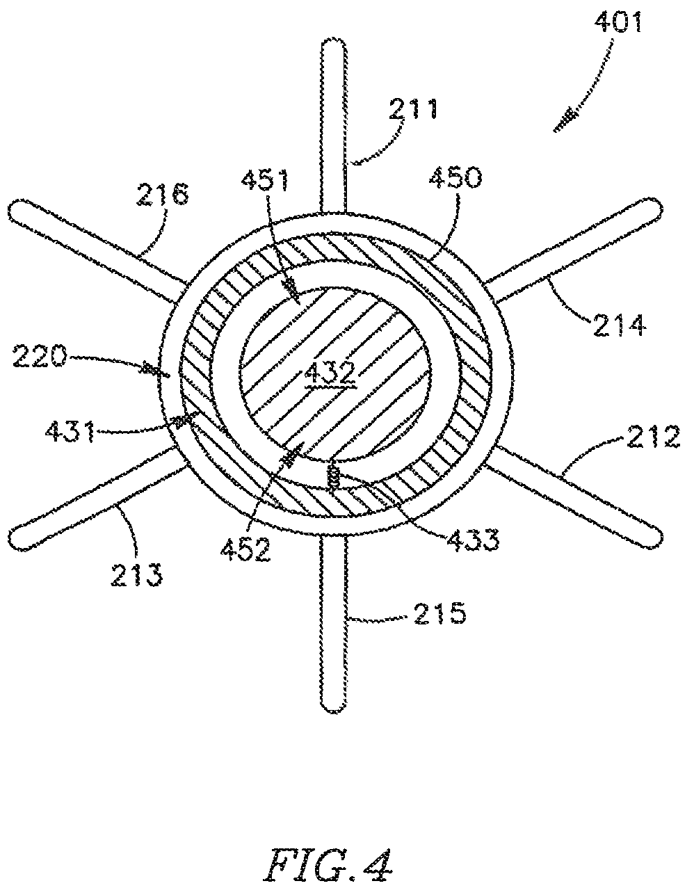 Patent US12303390 Figure 9 – Device and method for controlling in-vivo pressure