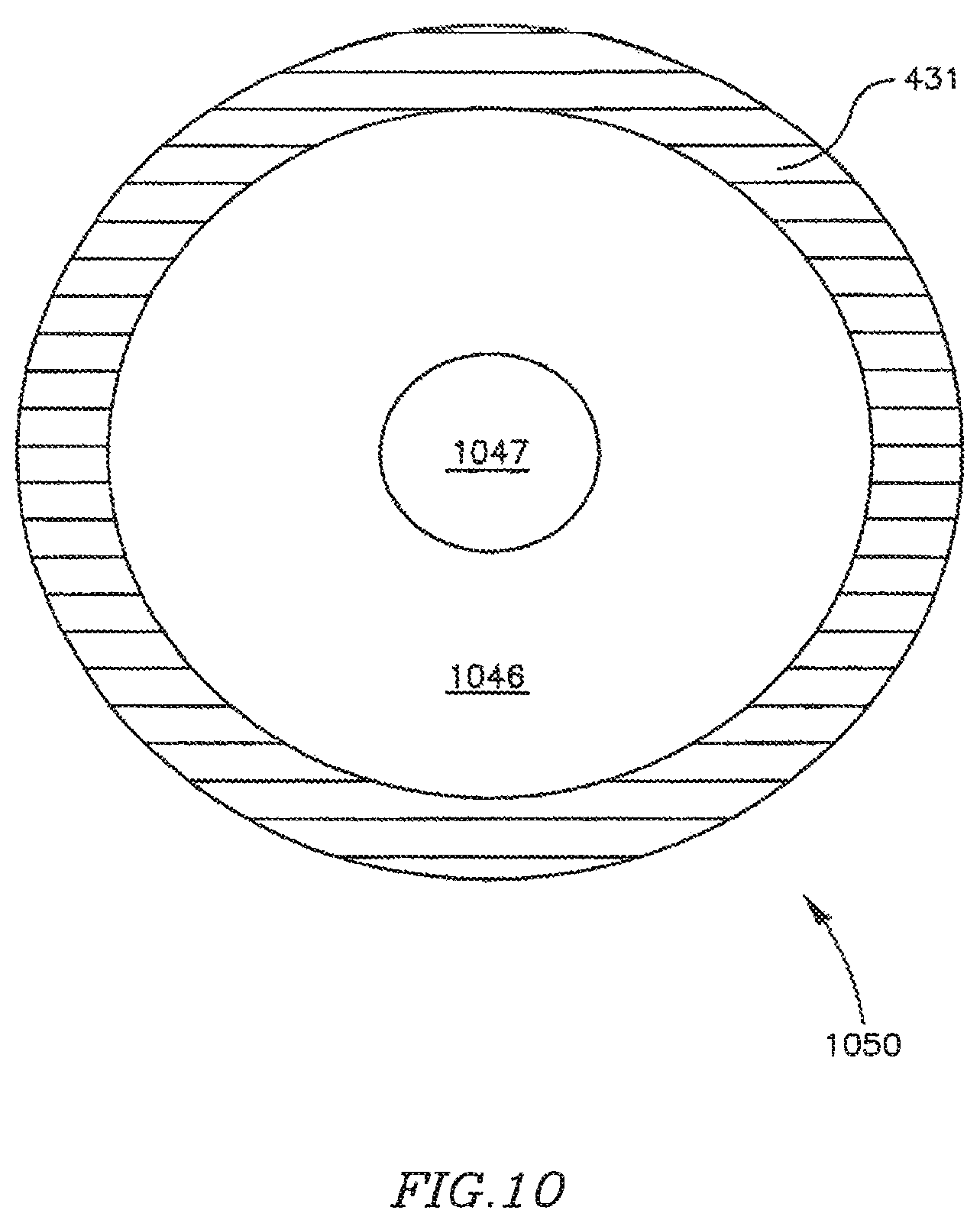 Patent US12303390 Figure 14 – Device and method for controlling in-vivo pressure