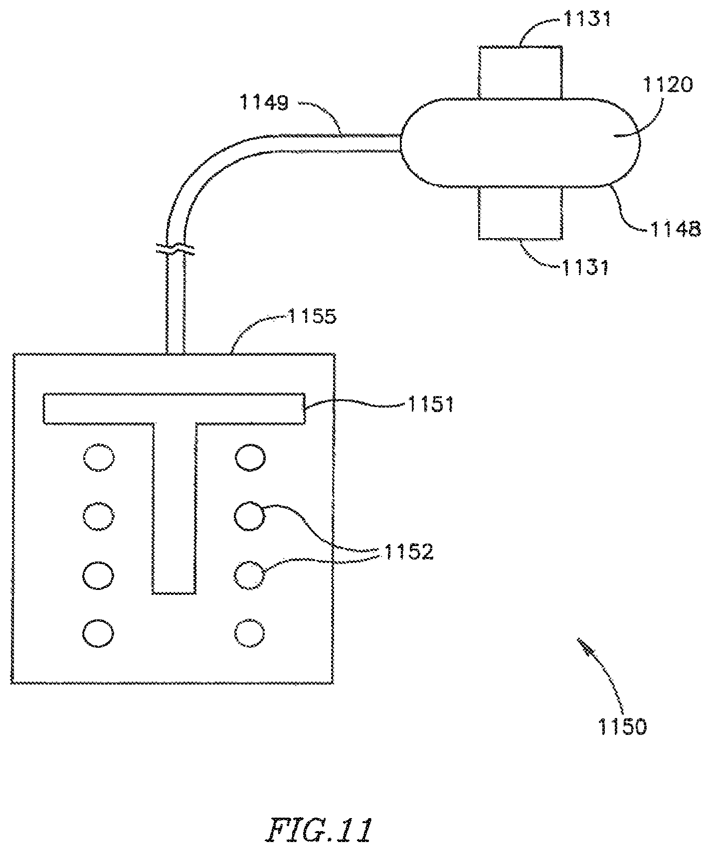 Patent US12303390 Figure 15 – Device and method for controlling in-vivo pressure