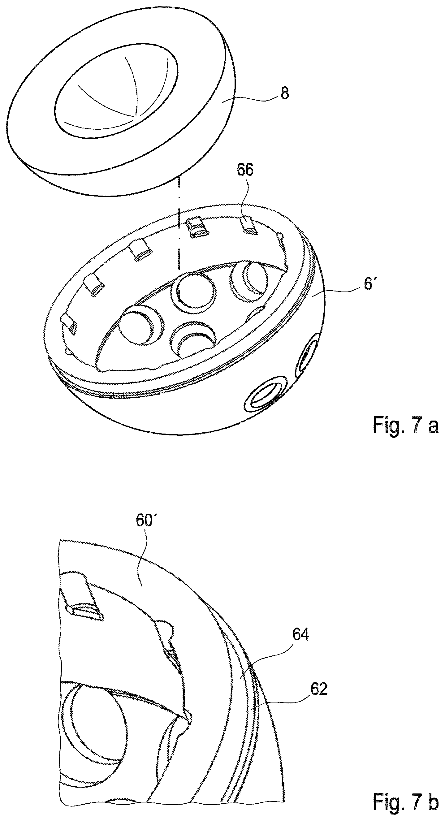 Patent US12303391 Figure 3 – Hip joint implant with reshapeable fastening brackets