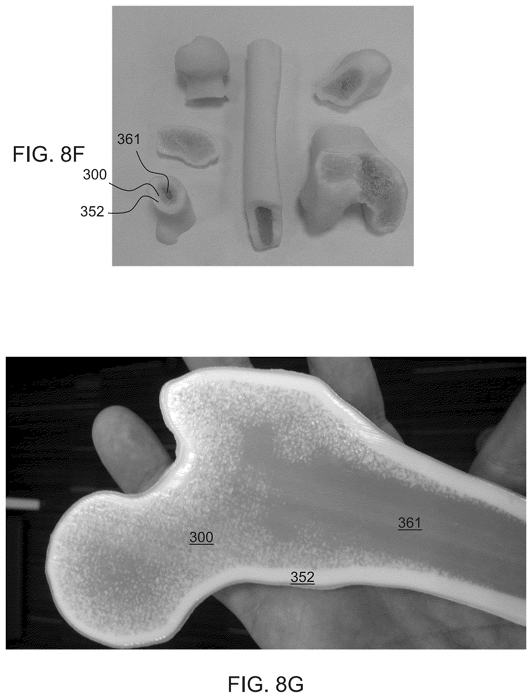 Patent US12303392 Figure 12 – Method and system for fabricating object featuring properties of a hard tissue