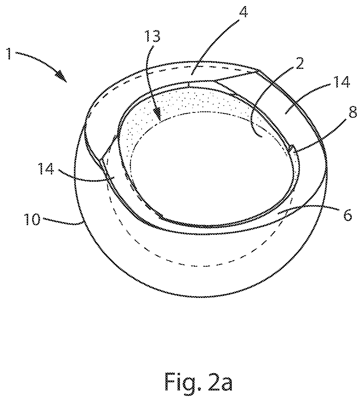 Patent US12303394 Figure 2 – Constrained acetabular liner
