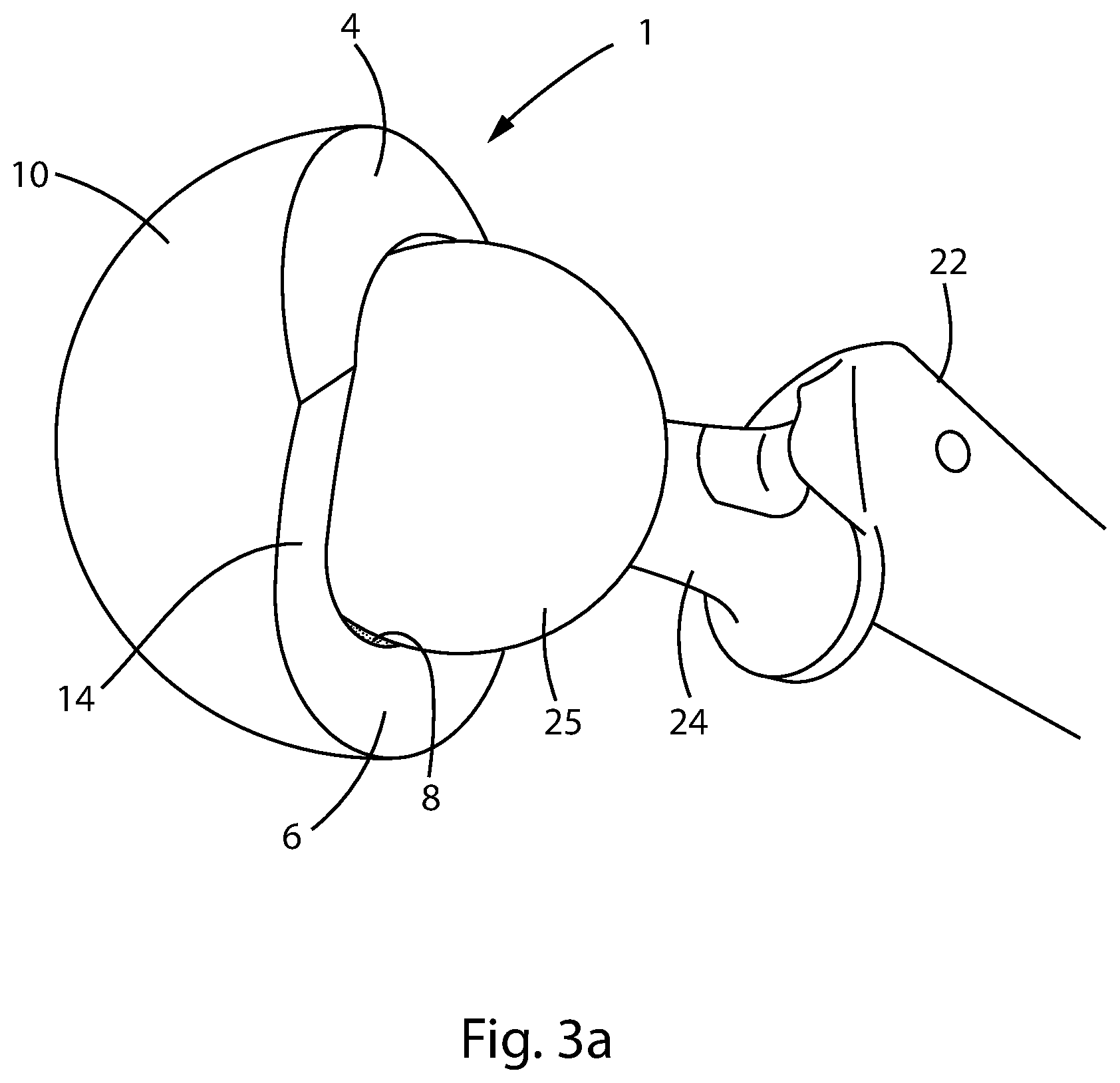 Patent US12303394 Figure 5 – Constrained acetabular liner