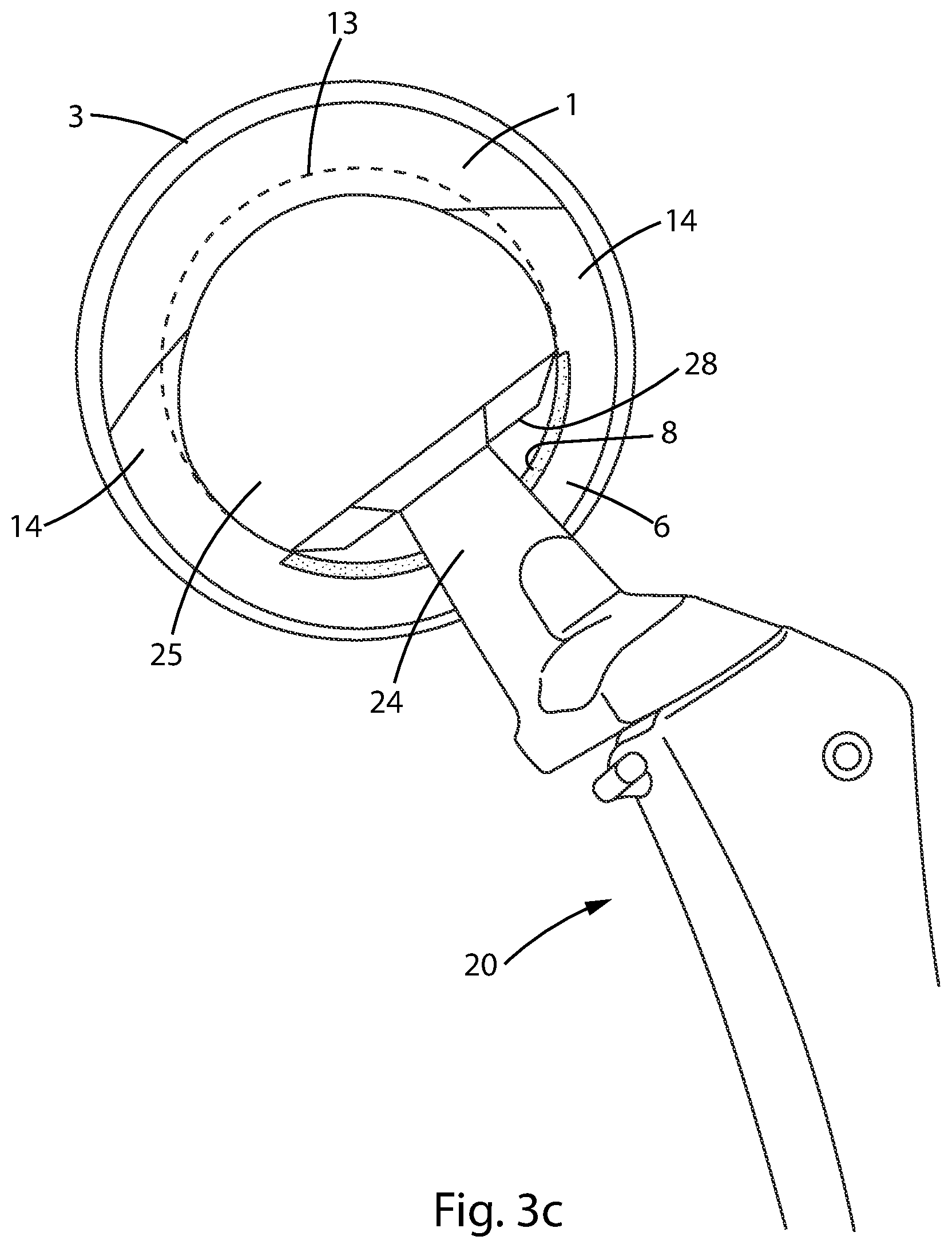 Patent US12303394 Figure 7 – Constrained acetabular liner