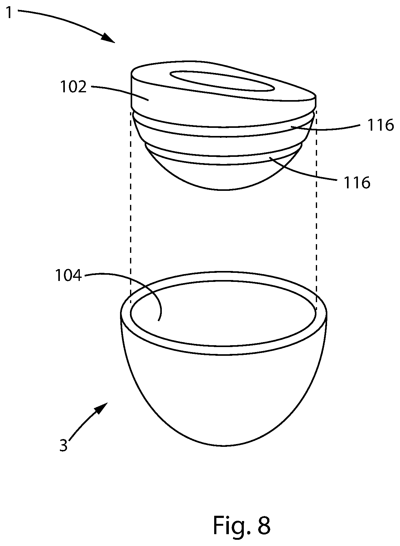 Patent US12303394 Figure 17 – Constrained acetabular liner