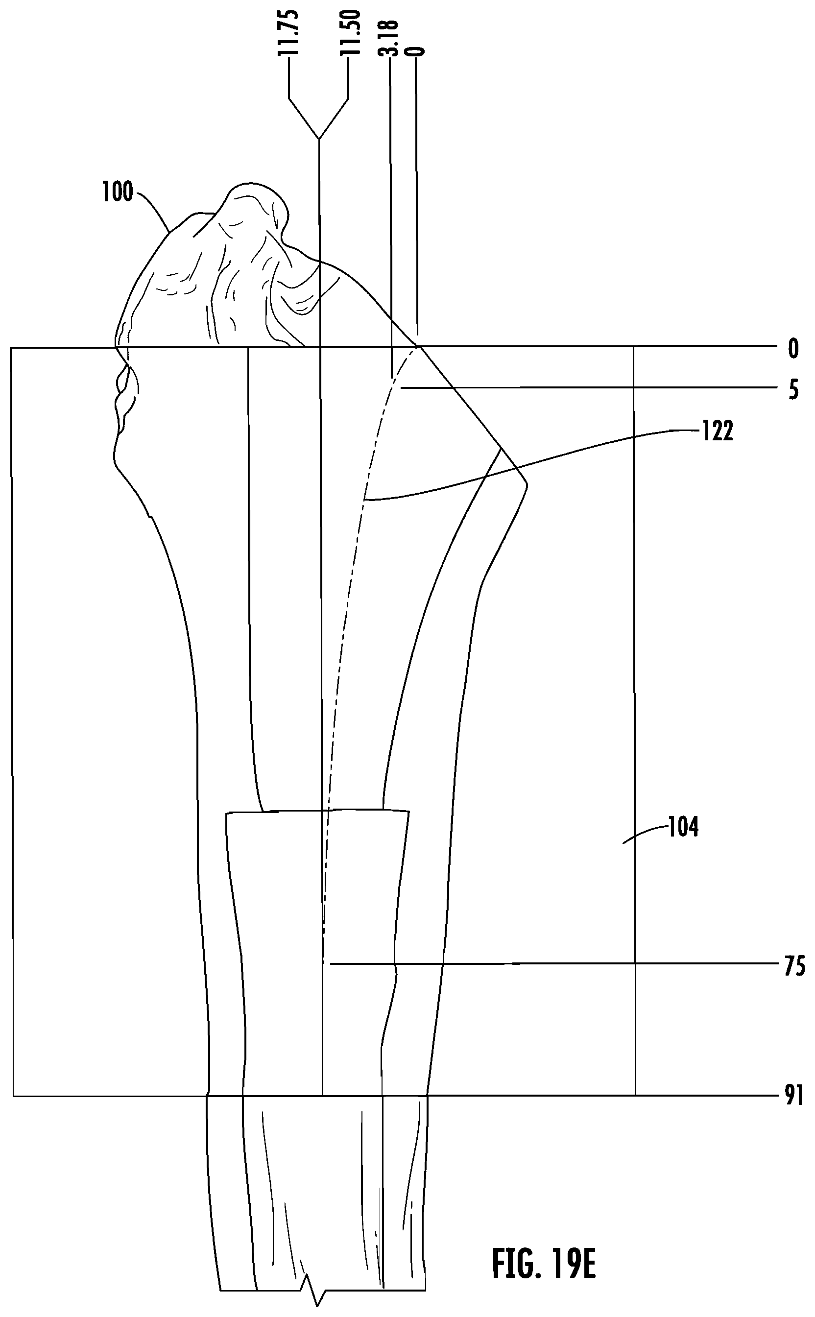Patent US12303395 Figure 11 – Hip implant