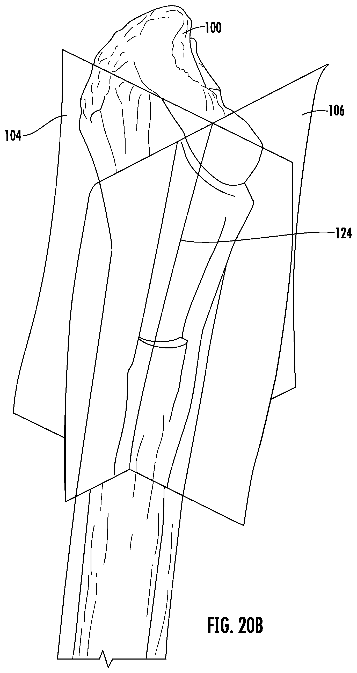 Patent US12303395 Figure 13 – Hip implant