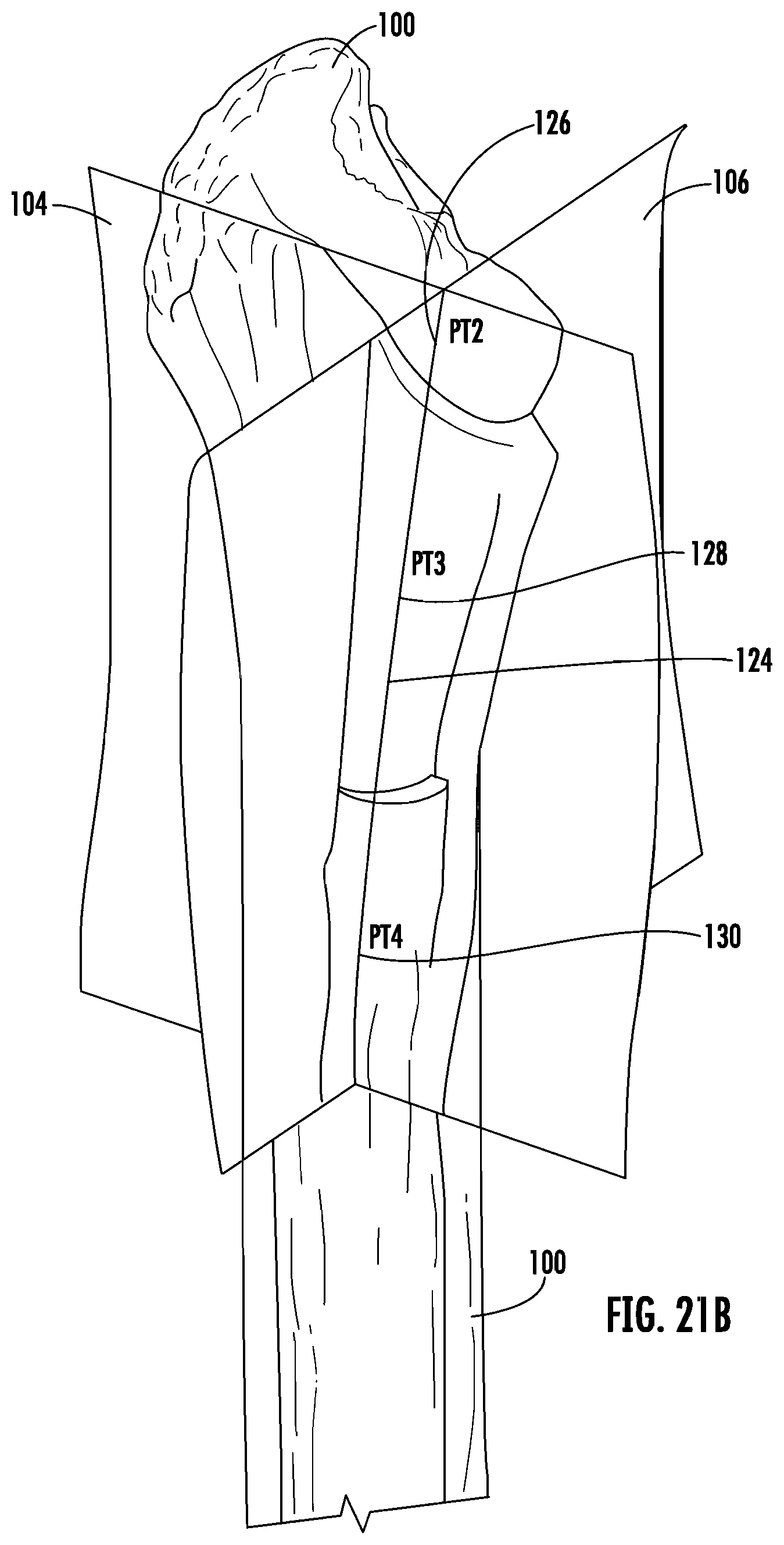Patent US12303395 Figure 15 – Hip implant