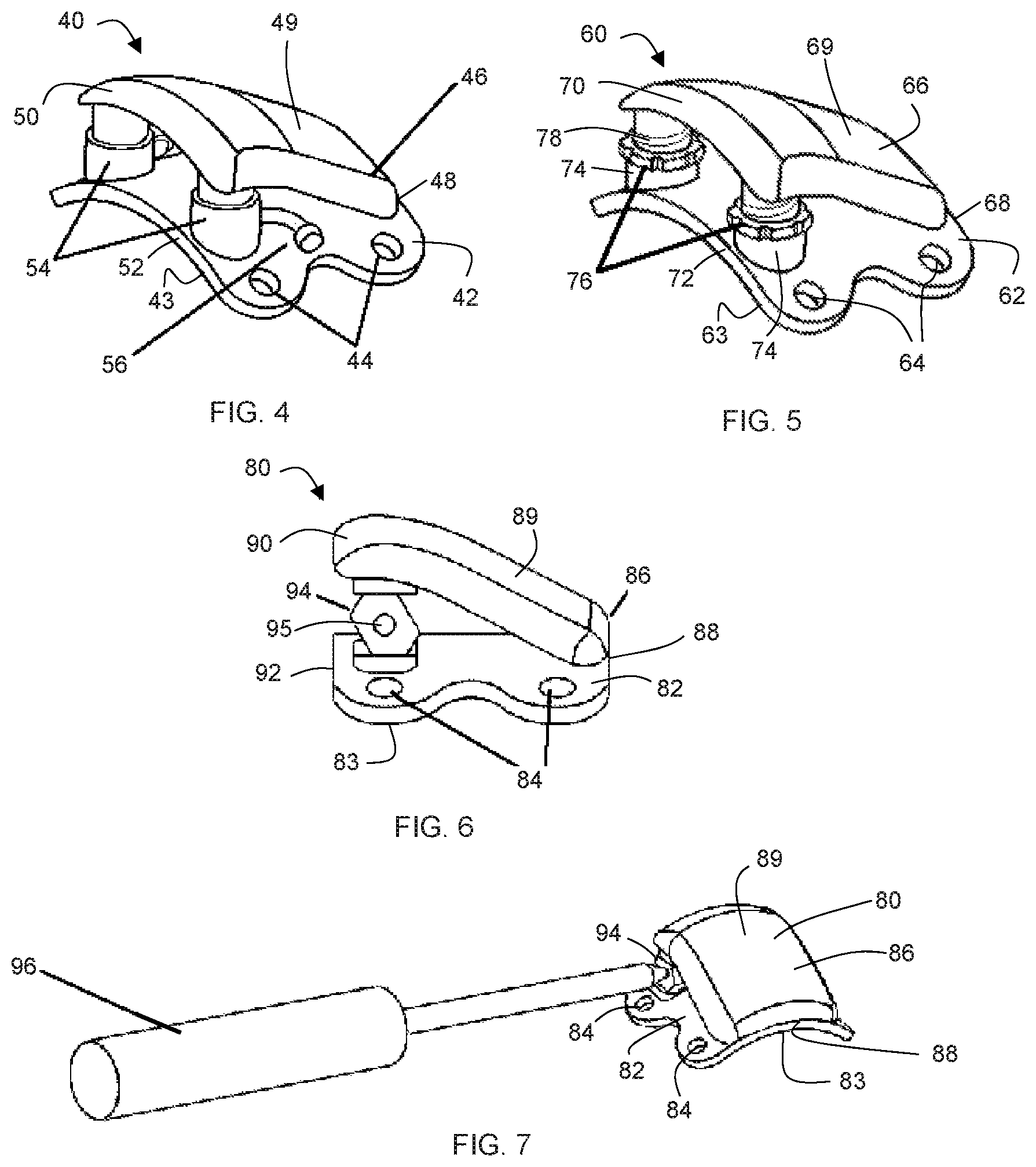Patent US12303396 Figure 2 – Adjustable patellar tendon realignment implant