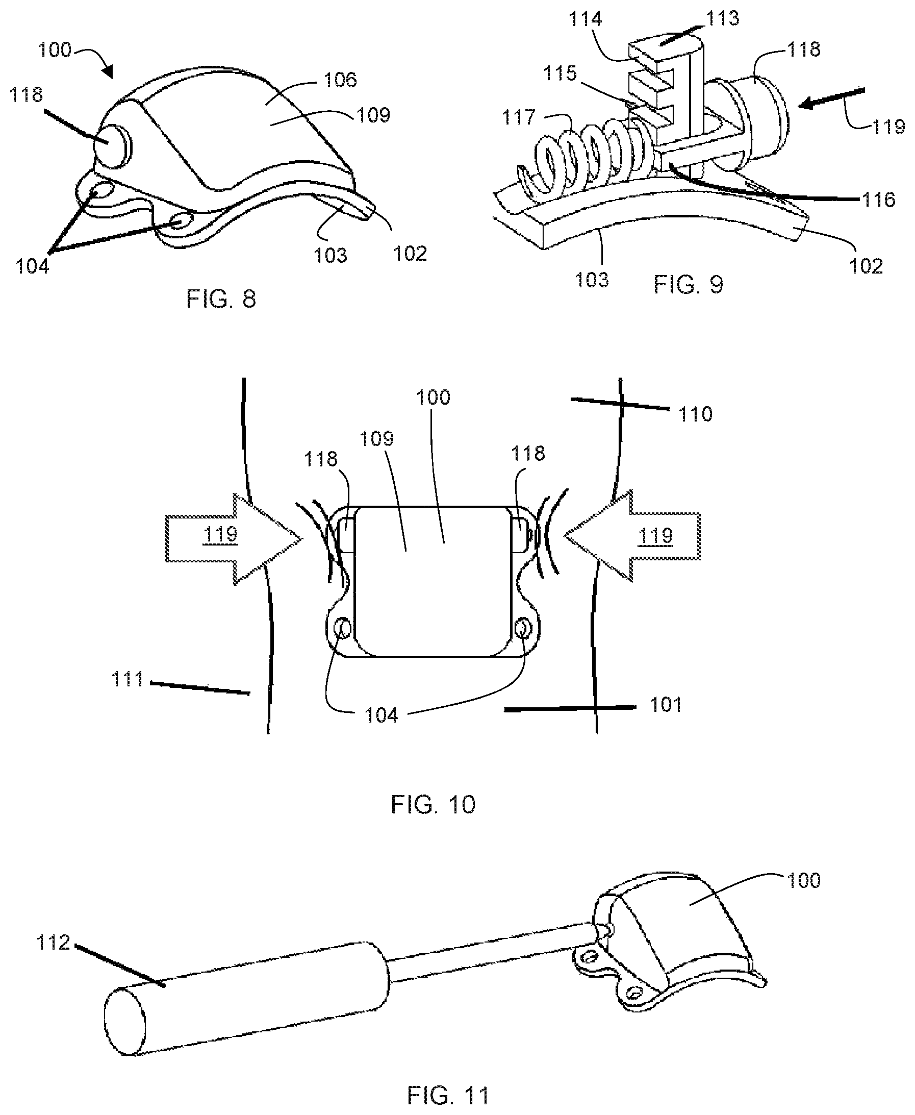 Patent US12303396 Figure 3 – Adjustable patellar tendon realignment implant