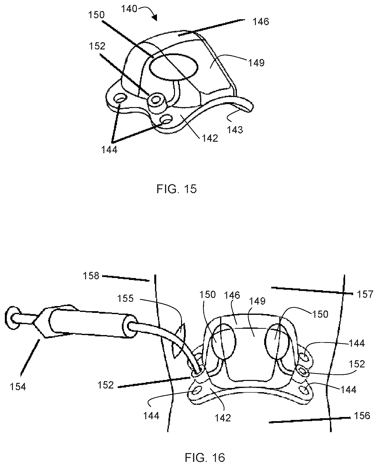 Patent US12303396 Figure 5 – Adjustable patellar tendon realignment implant