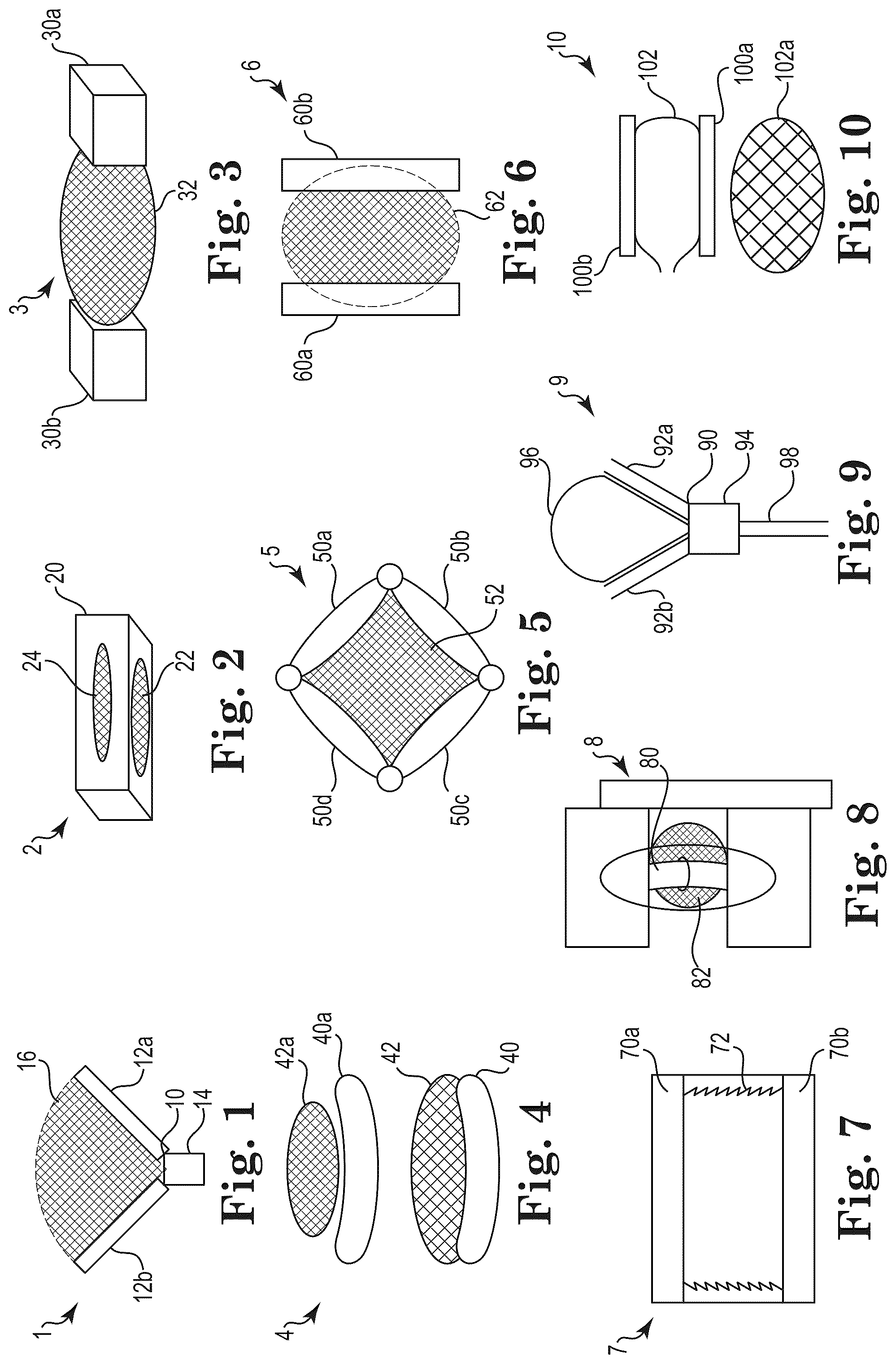 Patent US12303397 — Mesh spacer hybrid — Figure 1