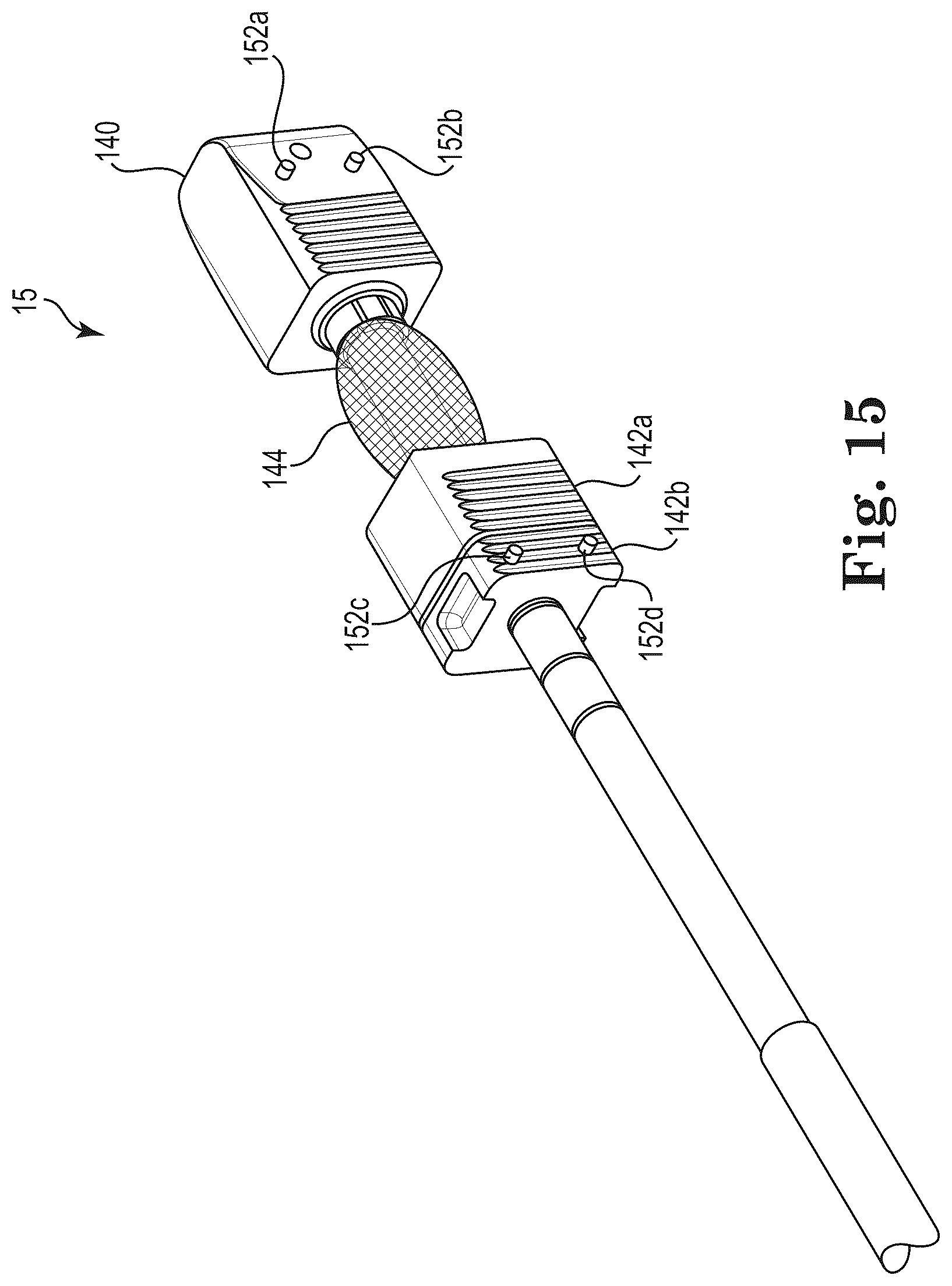 Patent US12303397 Figure 6 – Mesh spacer hybrid