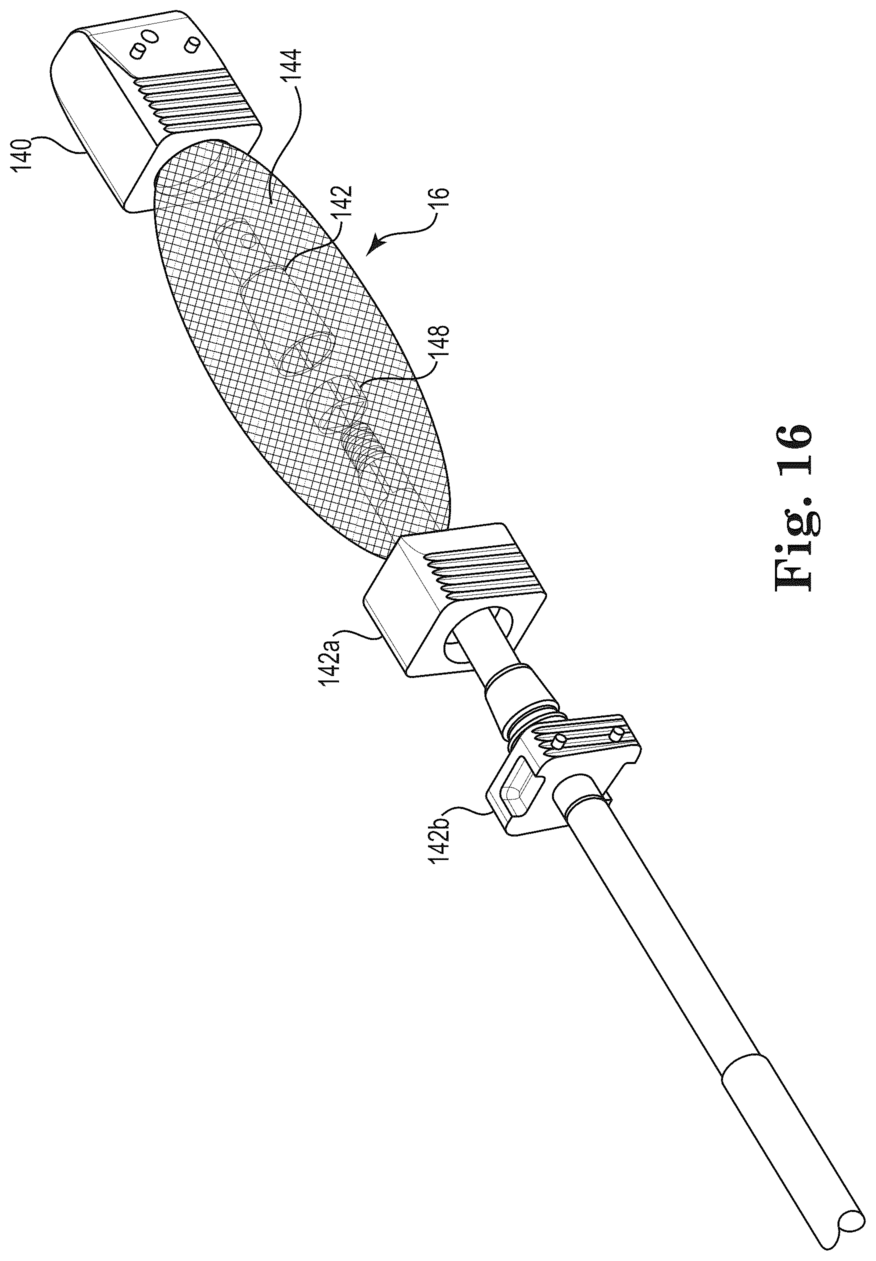 Patent US12303397 Figure 7 – Mesh spacer hybrid