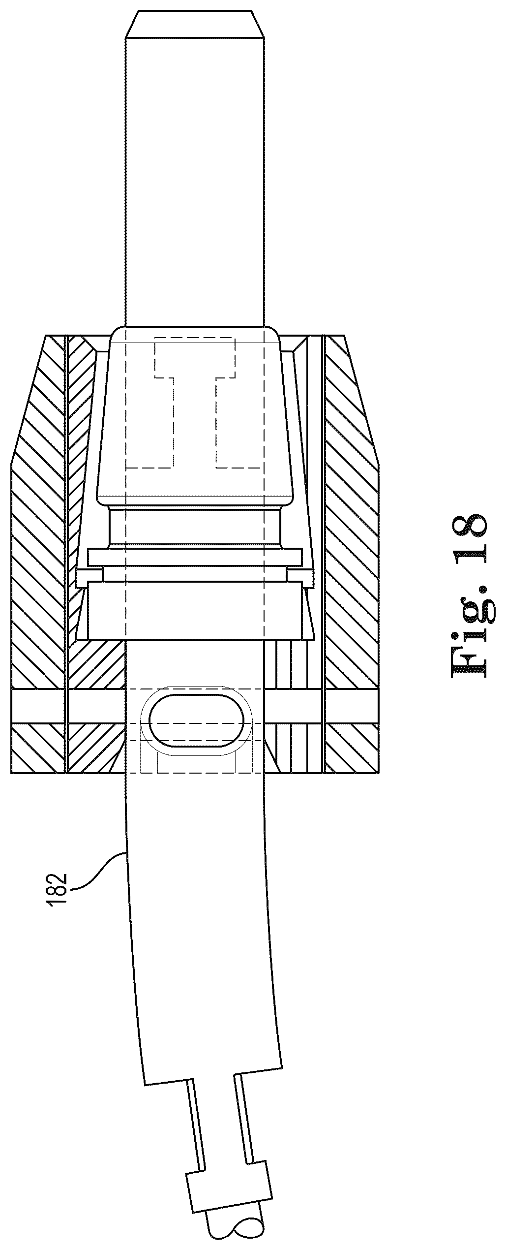 Patent US12303397 Figure 9 – Mesh spacer hybrid