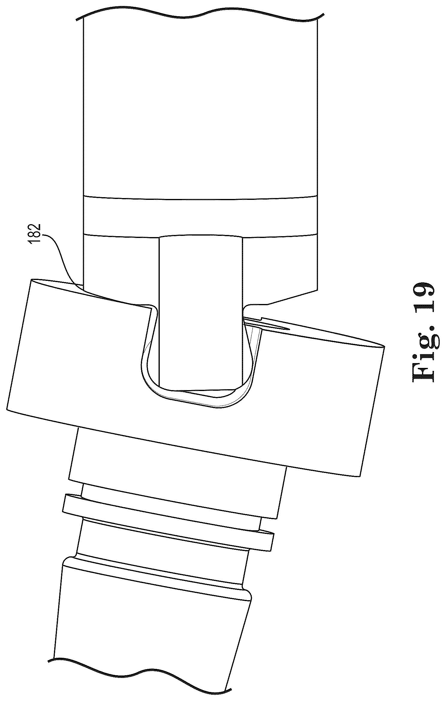 Patent US12303397 Figure 10 – Mesh spacer hybrid