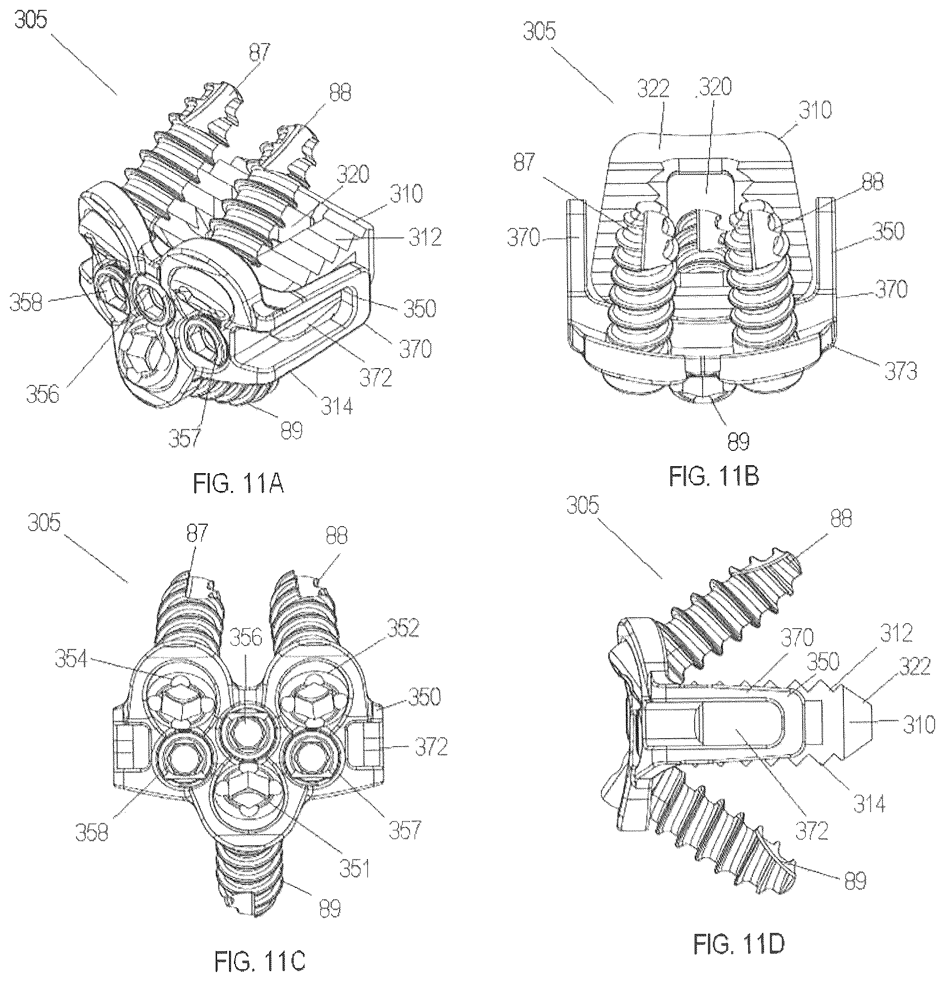Patent US12303398 Figure 11 – Low profile plate