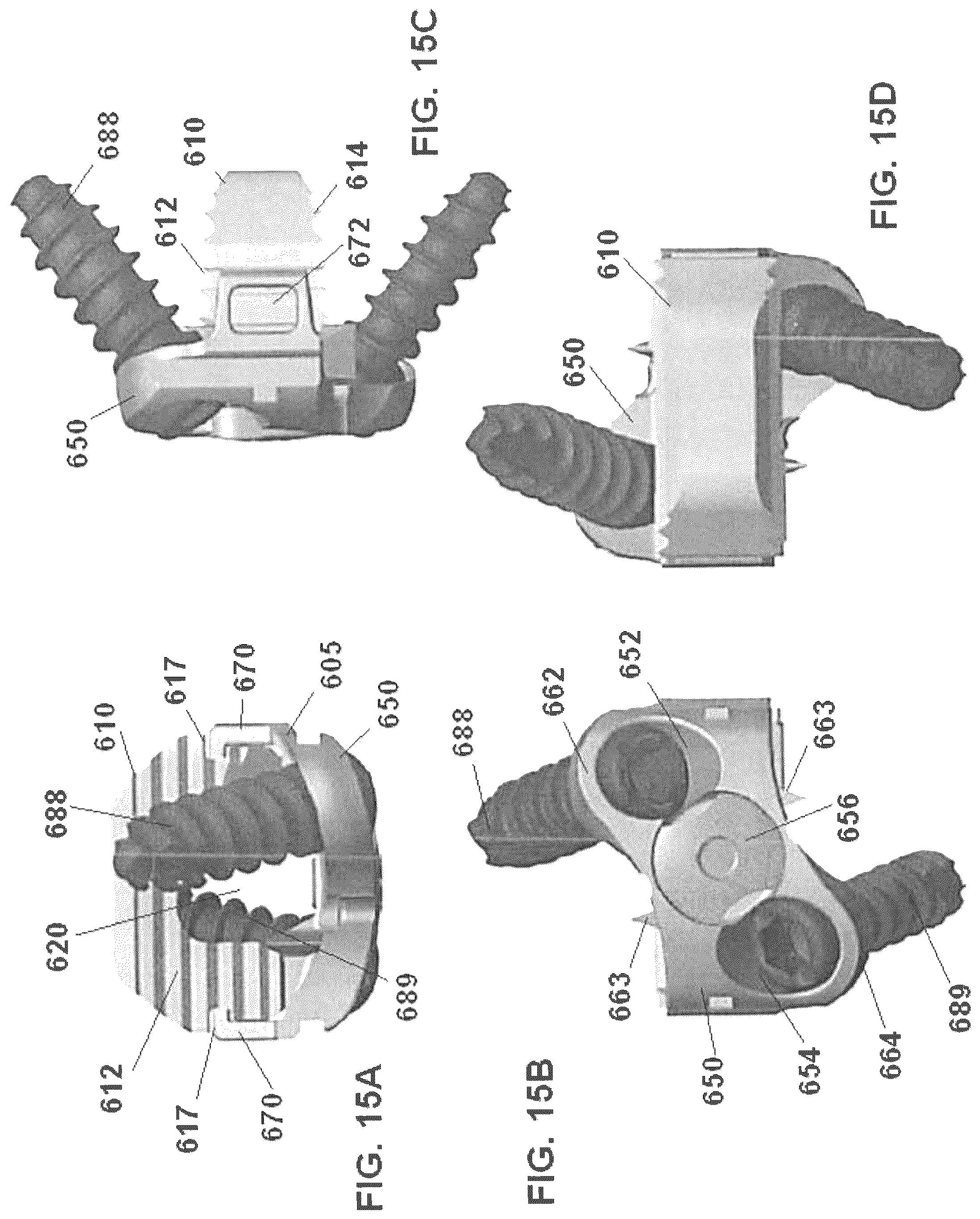 Patent US12303398 Figure 15 – Low profile plate