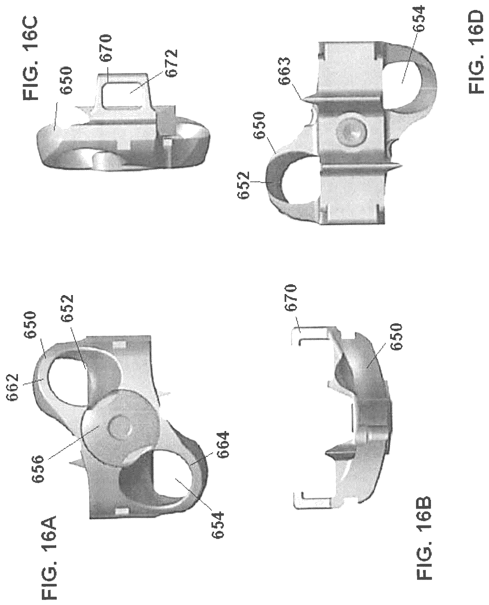 Patent US12303398 Figure 16 – Low profile plate
