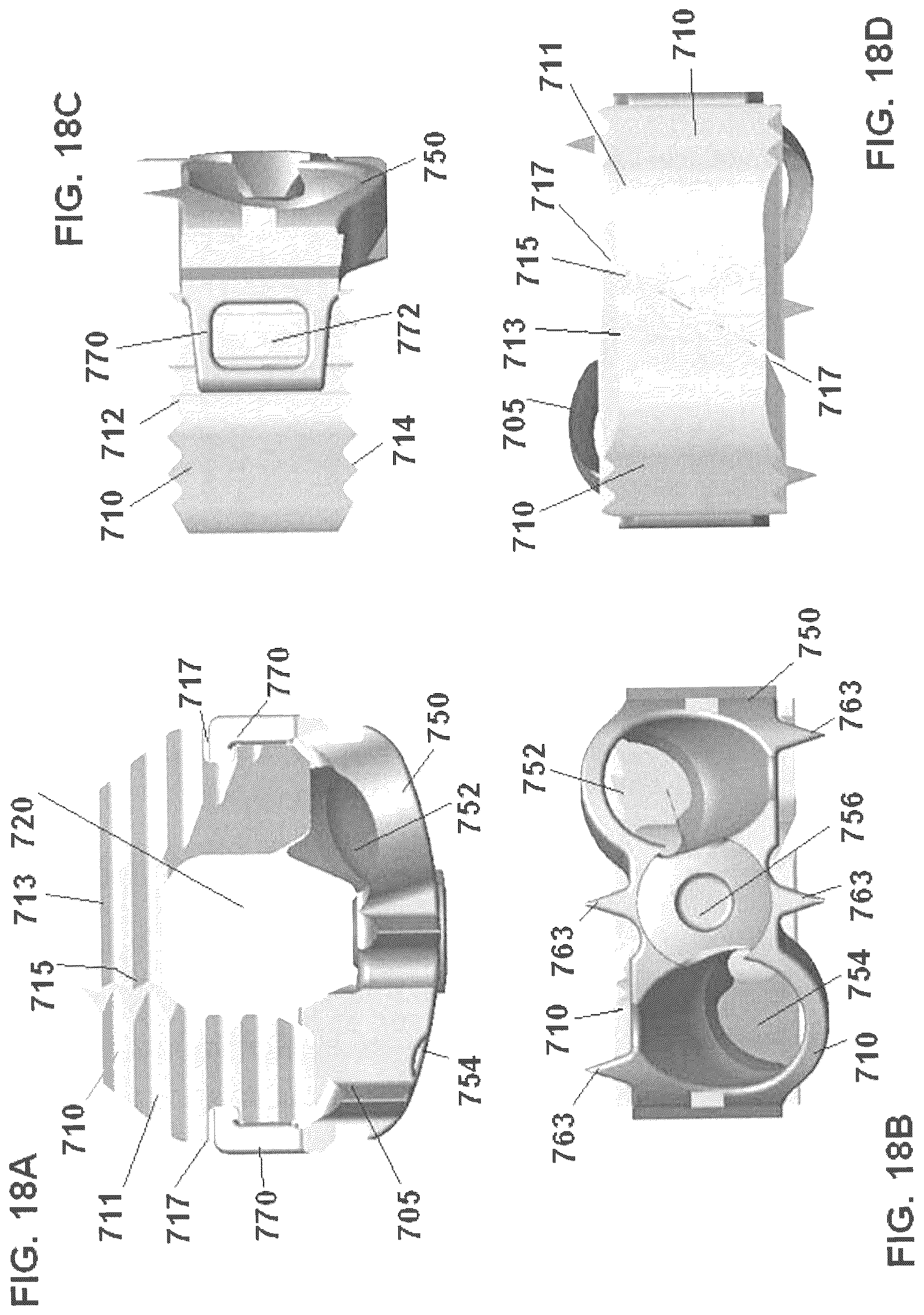 Patent US12303398 Figure 18 – Low profile plate