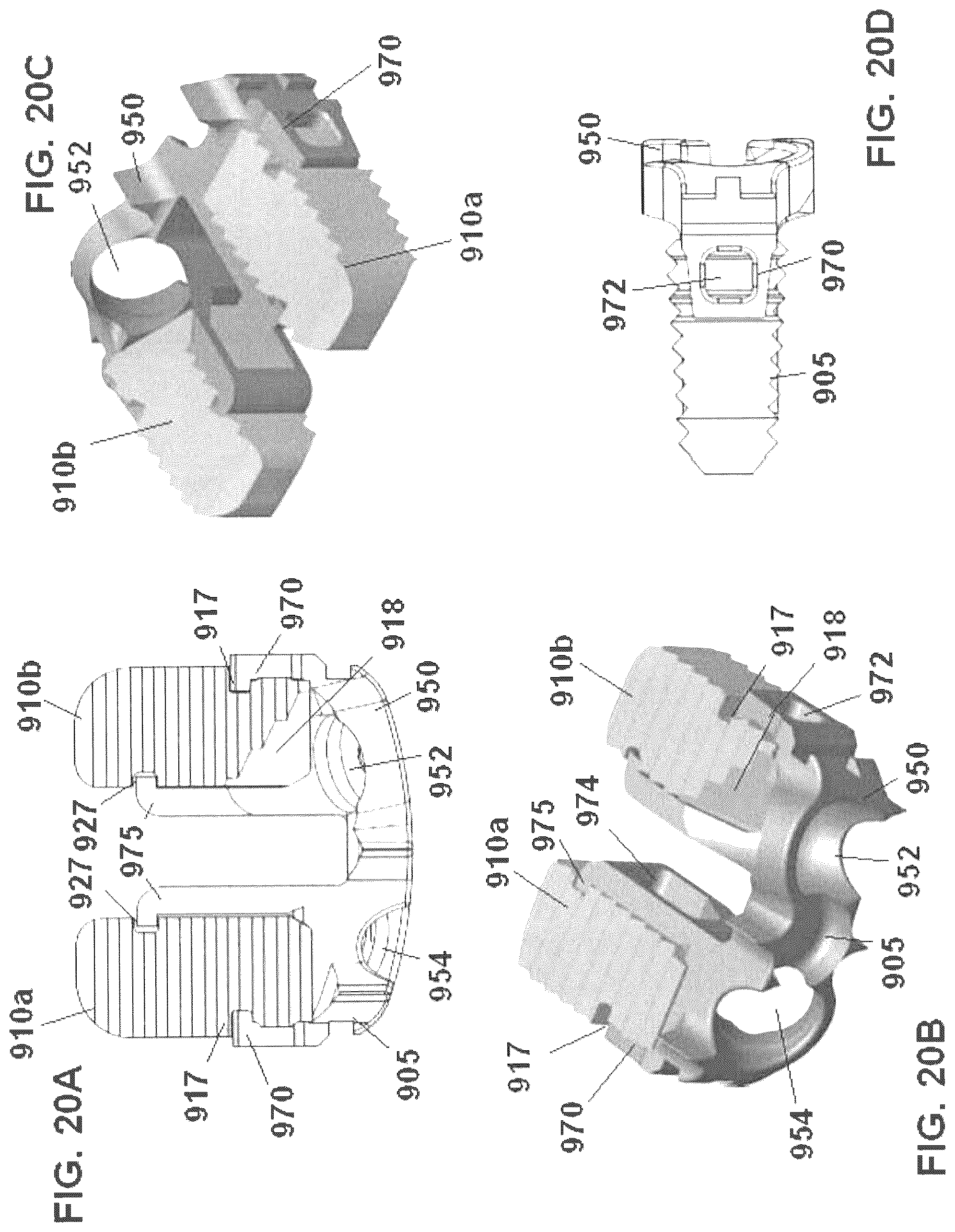 Patent US12303398 Figure 20 – Low profile plate