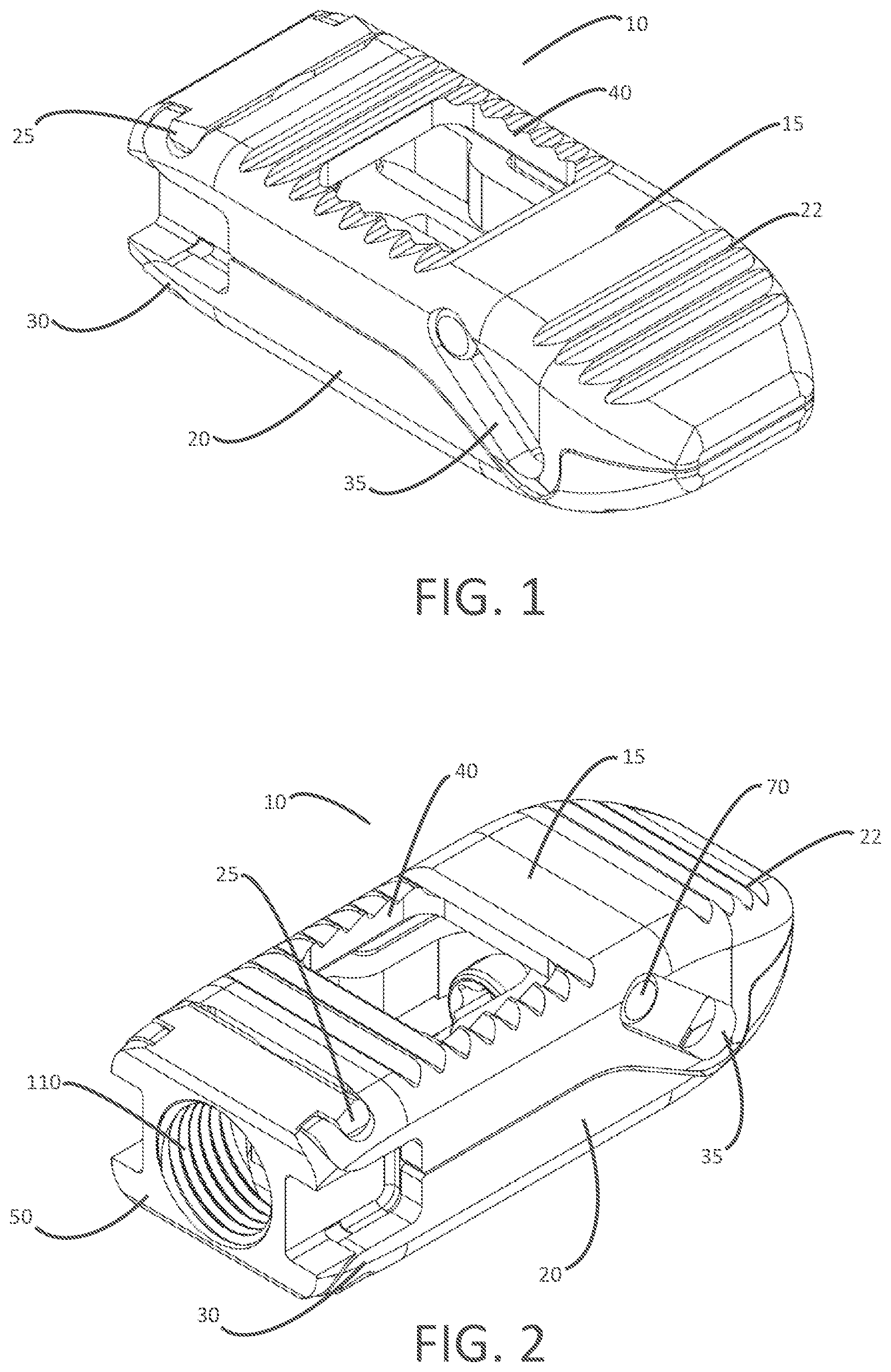 Patent US12303399 Figure 1 – Expandable lordotic interbodies and related methods