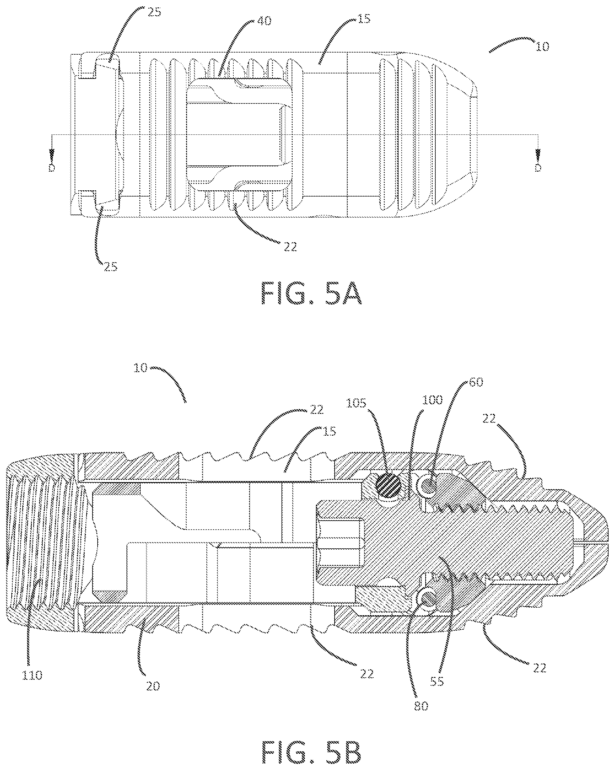 Patent US12303399 Figure 3 – Expandable lordotic interbodies and related methods