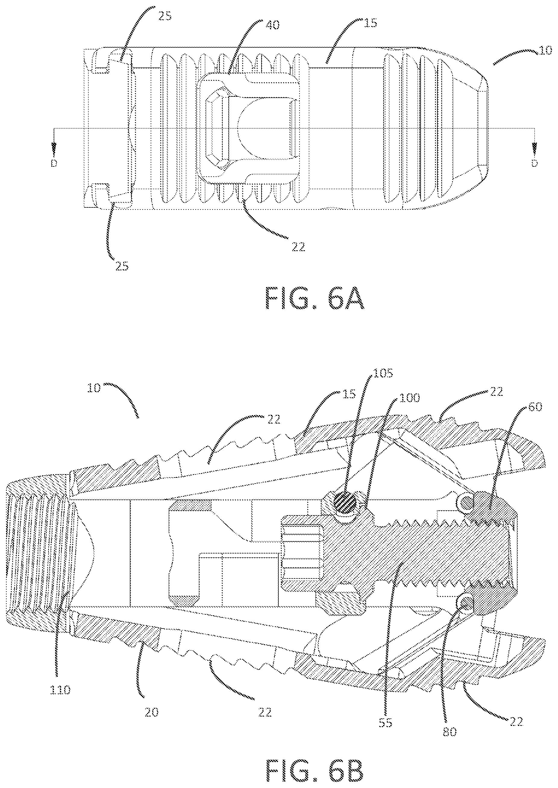 Patent US12303399 Figure 4 – Expandable lordotic interbodies and related methods
