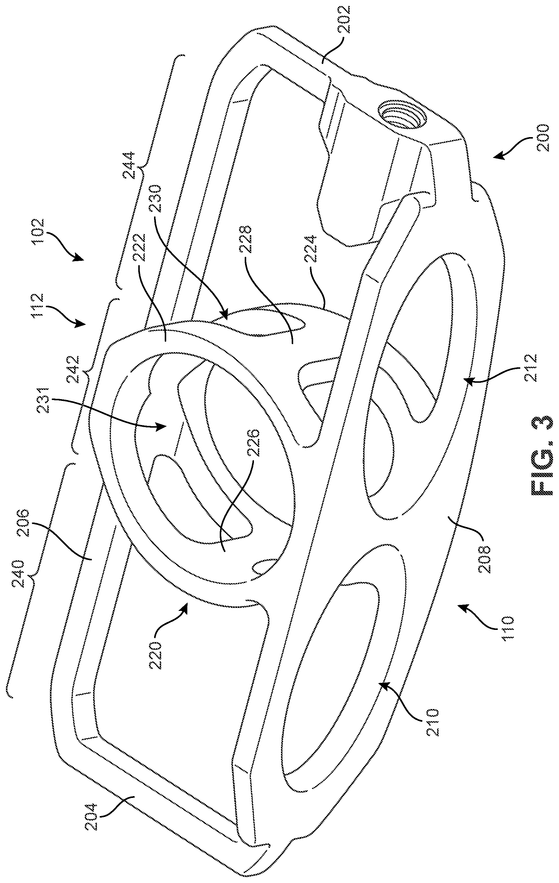 Patent US12303400 Figure 3 – Implant with structural members arranged around a ring