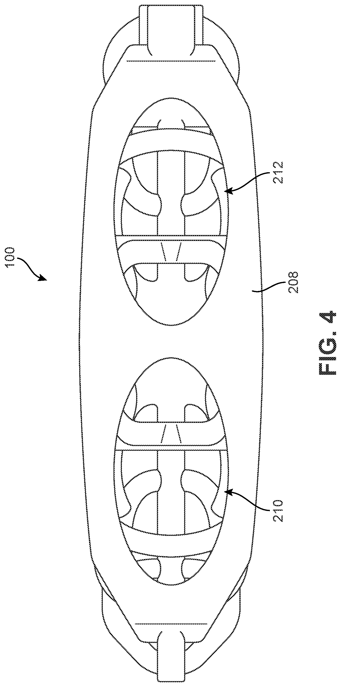Patent US12303400 Figure 4 – Implant with structural members arranged around a ring