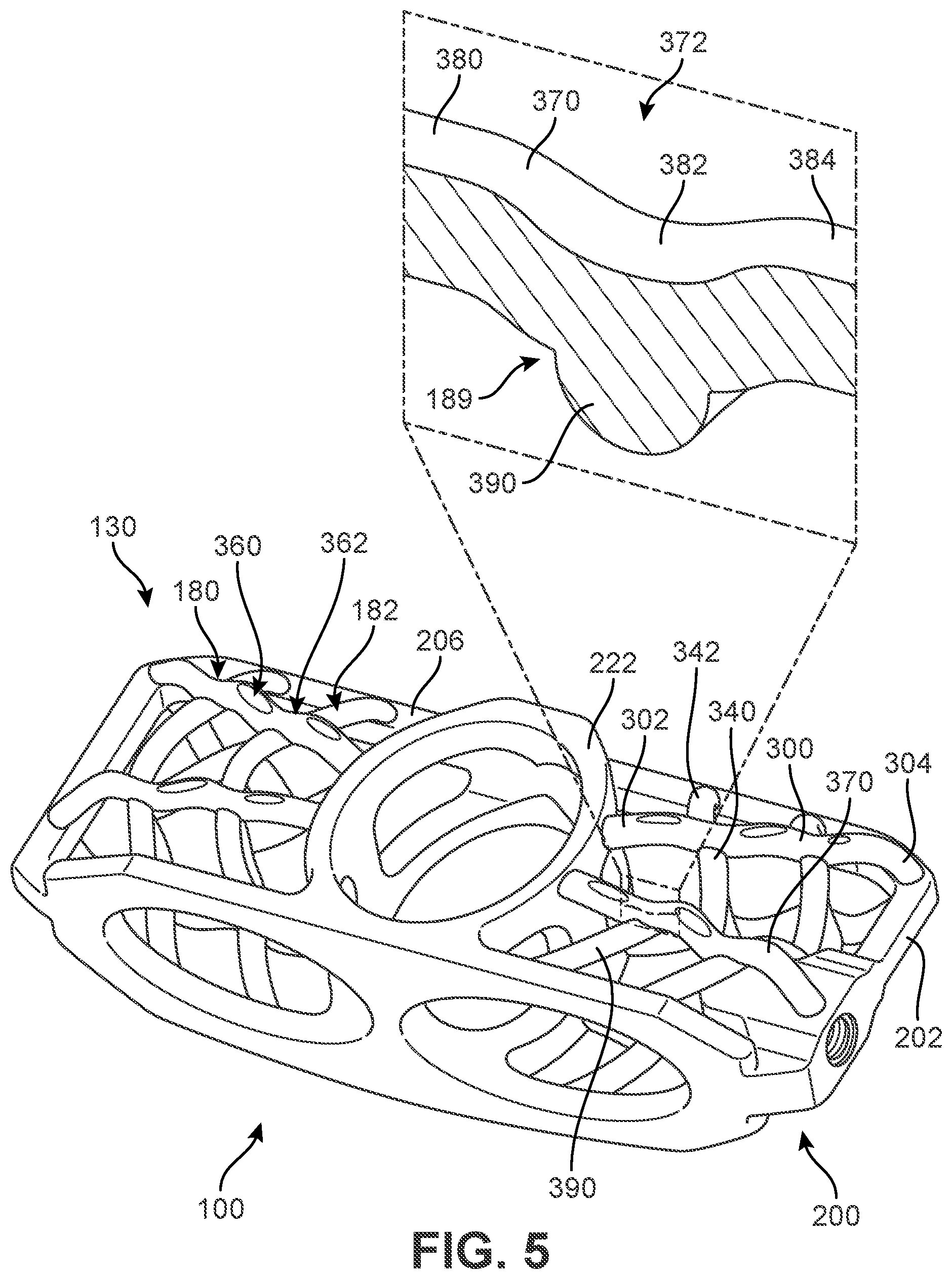 Patent US12303400 Figure 5 – Implant with structural members arranged around a ring