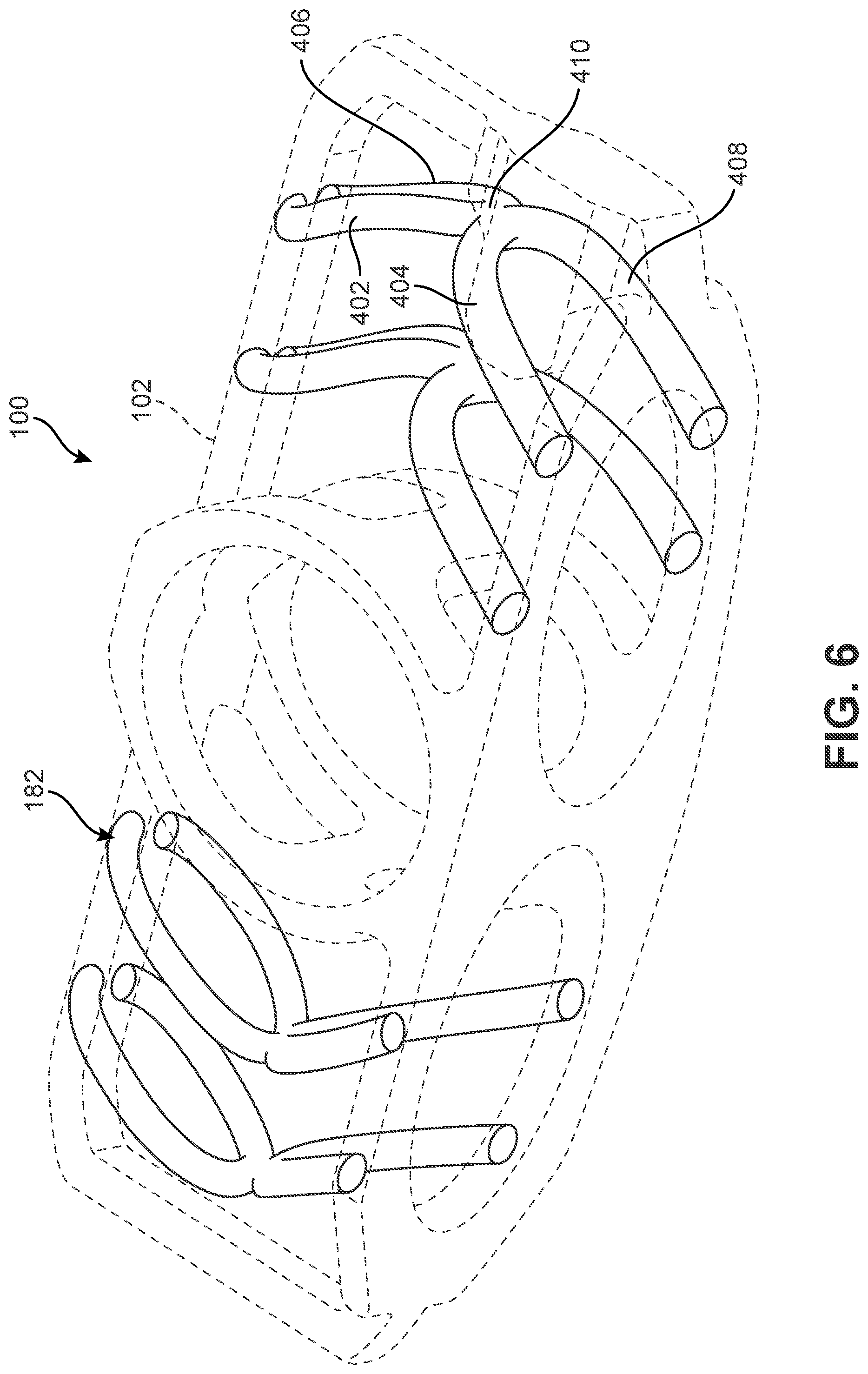 Patent US12303400 Figure 6 – Implant with structural members arranged around a ring