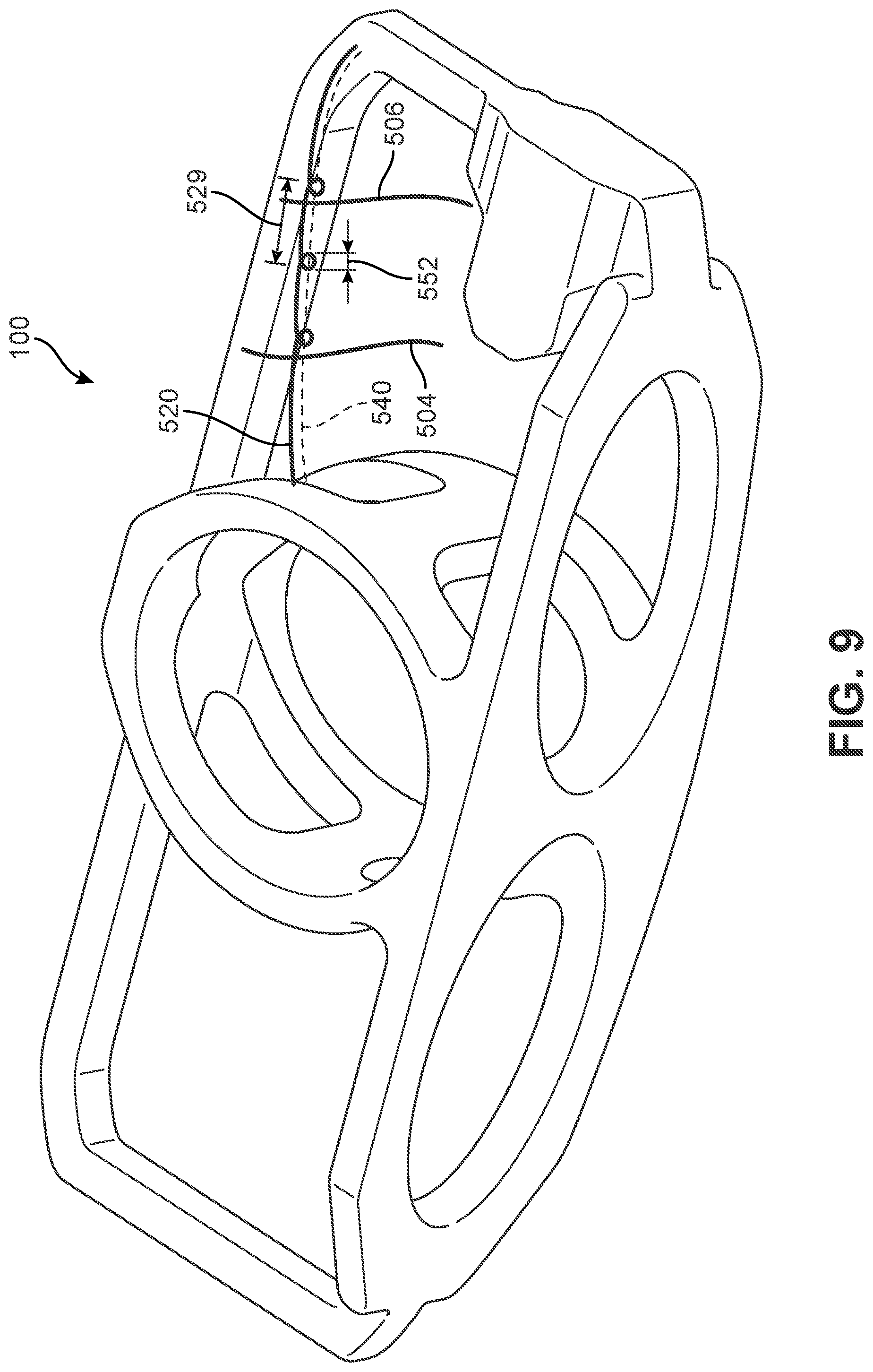 Patent US12303400 Figure 8 – Implant with structural members arranged around a ring