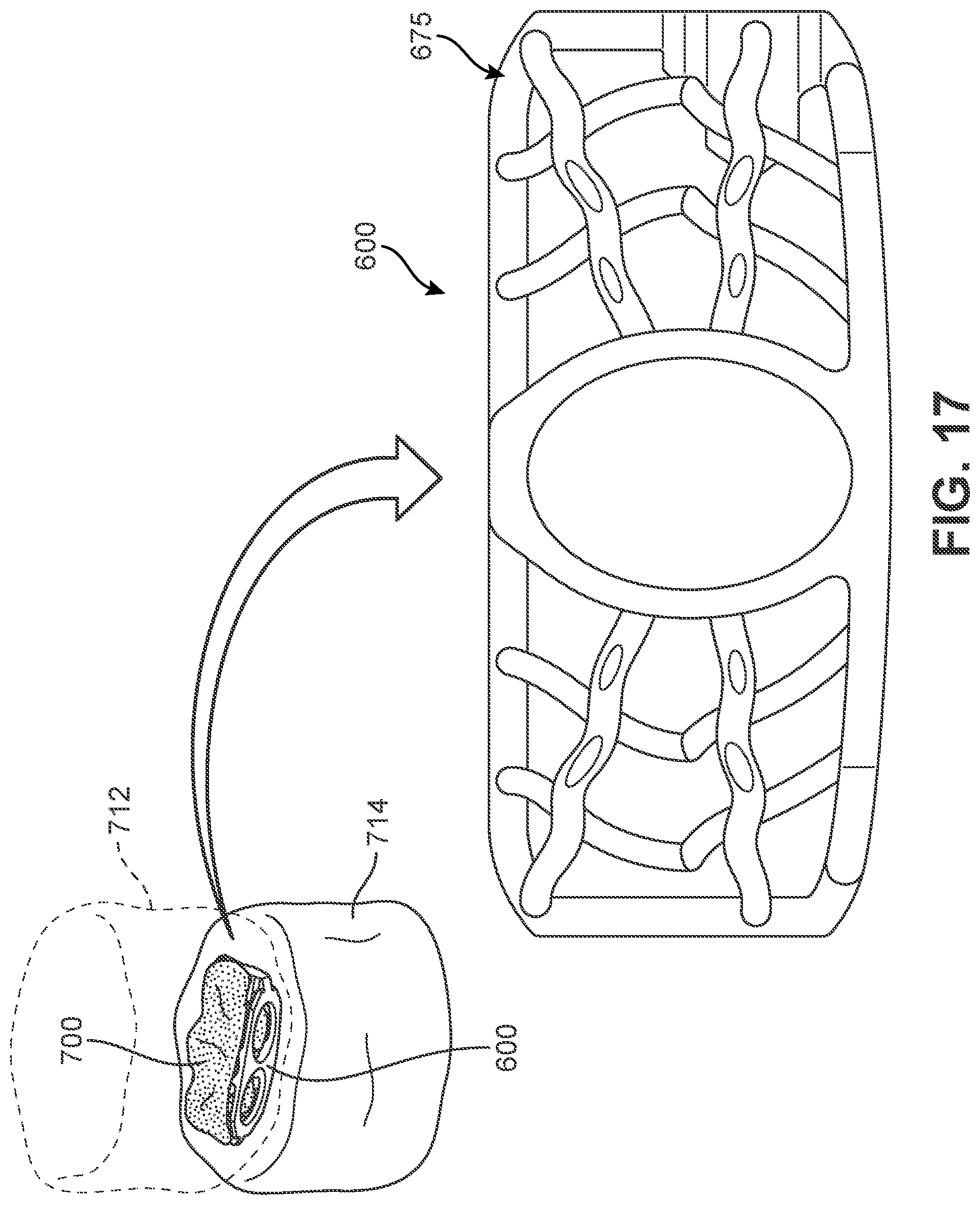 Patent US12303400 Figure 16 – Implant with structural members arranged around a ring