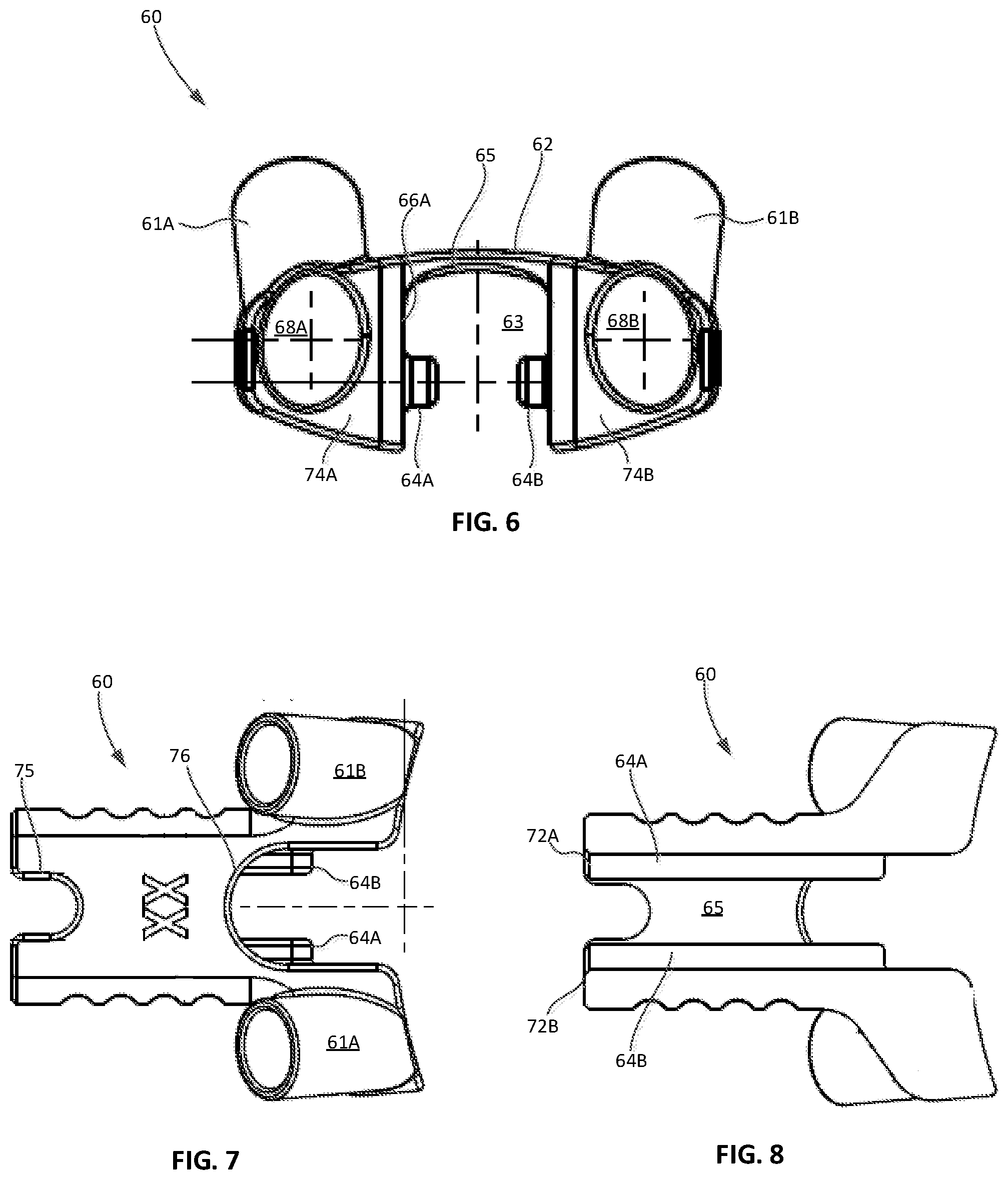 Patent US12303401 Figure 4 – Tritanium AL implants and instrumentation