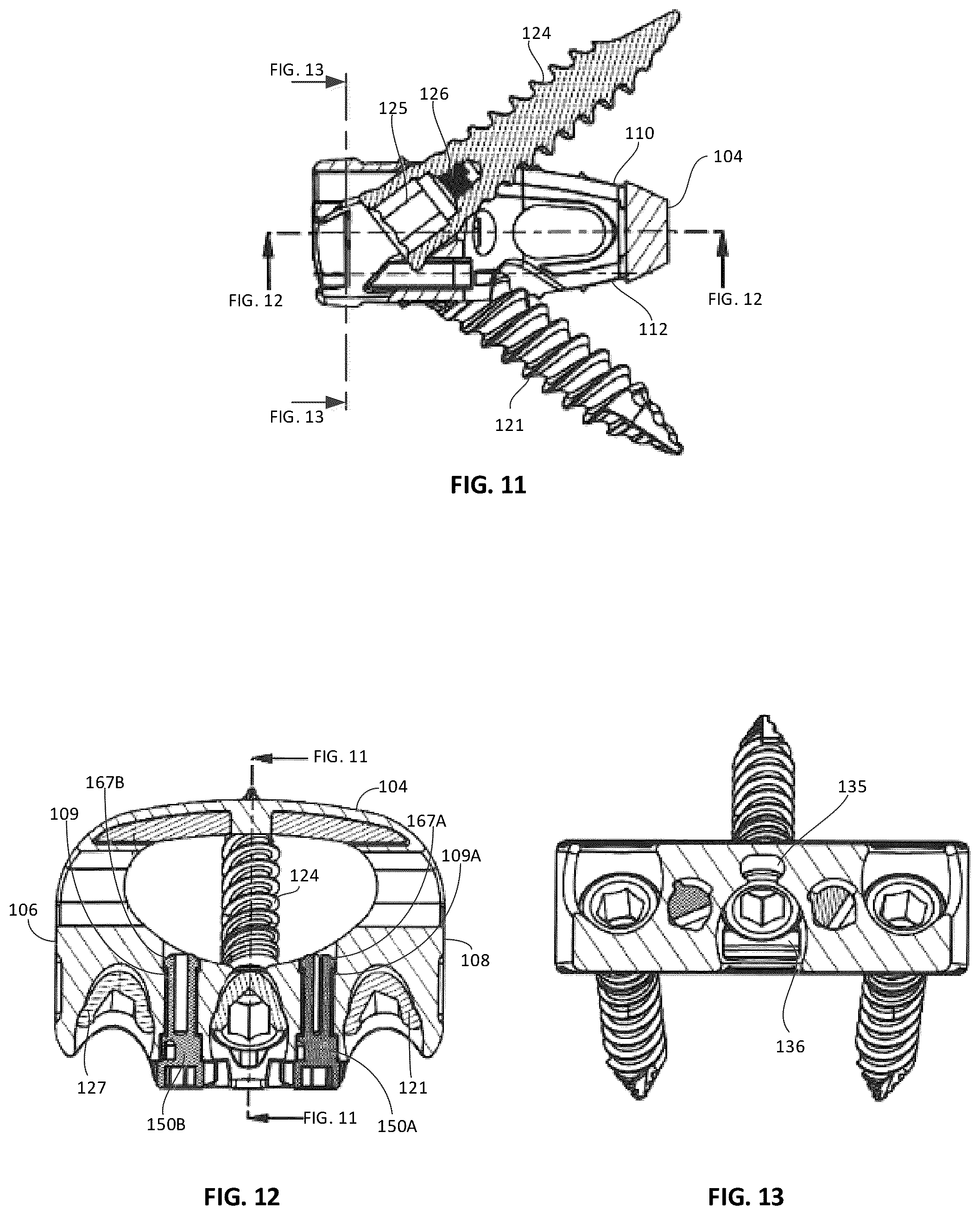 Patent US12303401 Figure 6 – Tritanium AL implants and instrumentation