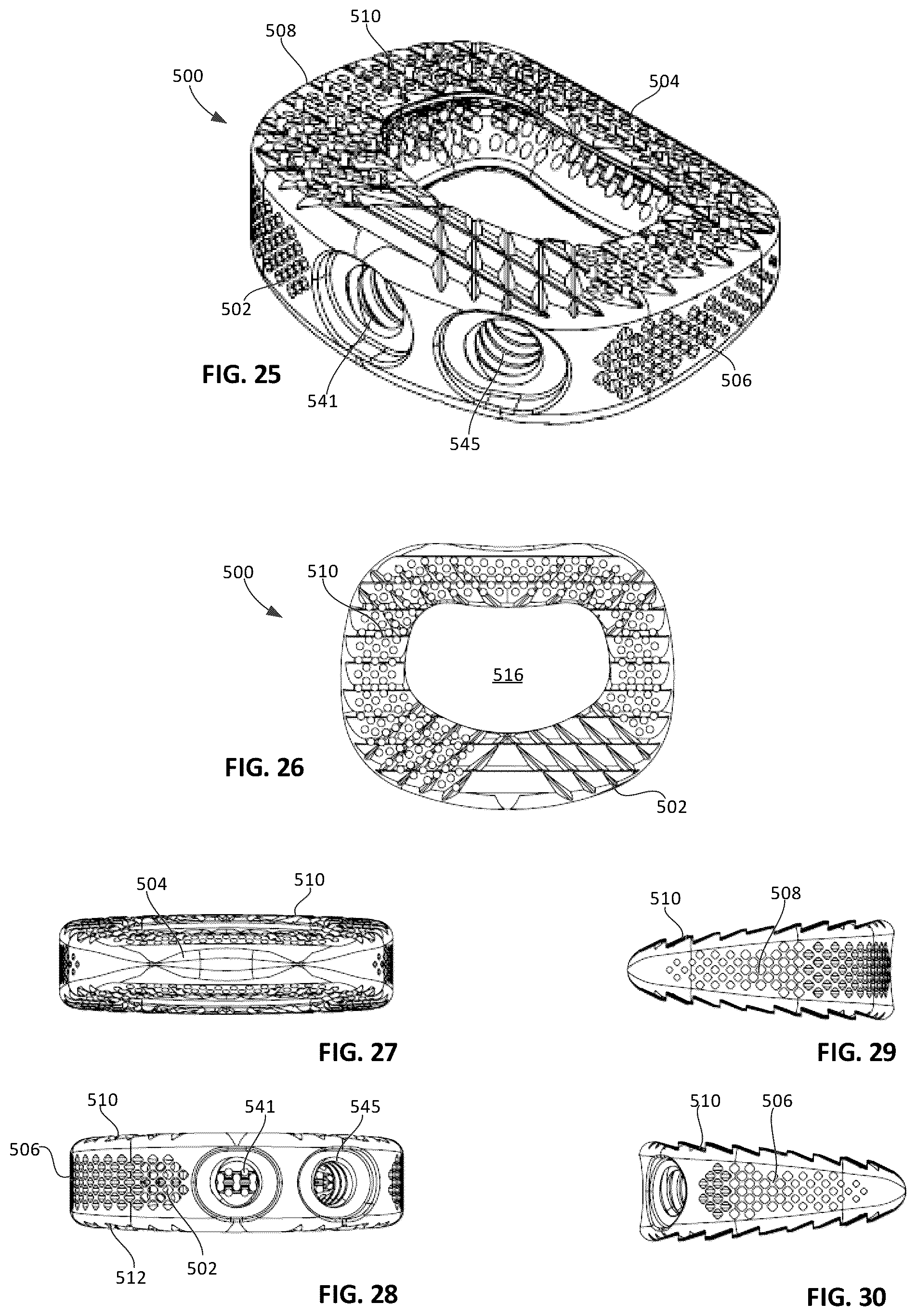 Patent US12303401 Figure 11 – Tritanium AL implants and instrumentation