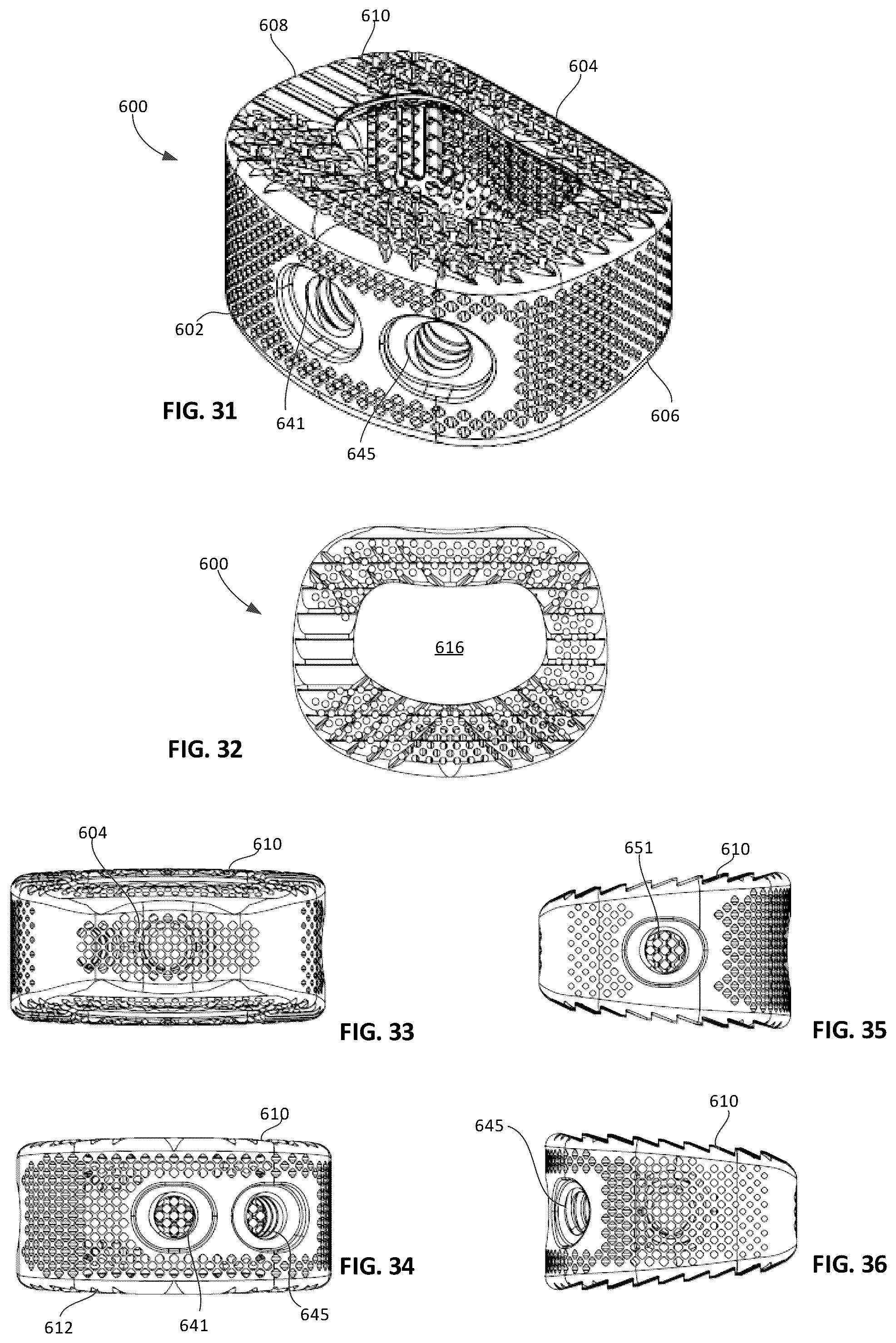 Patent US12303401 Figure 12 – Tritanium AL implants and instrumentation