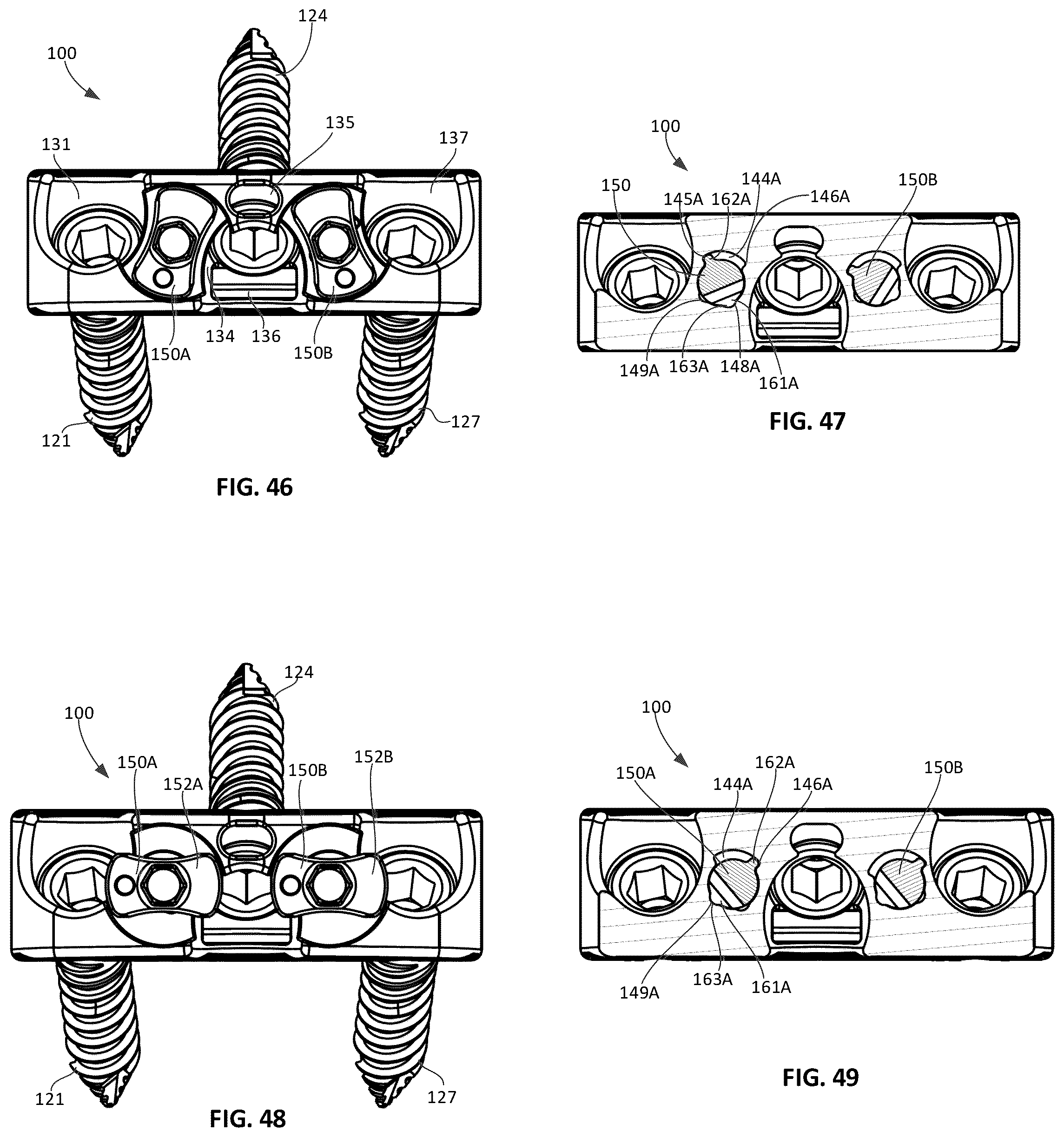 Patent US12303401 Figure 16 – Tritanium AL implants and instrumentation