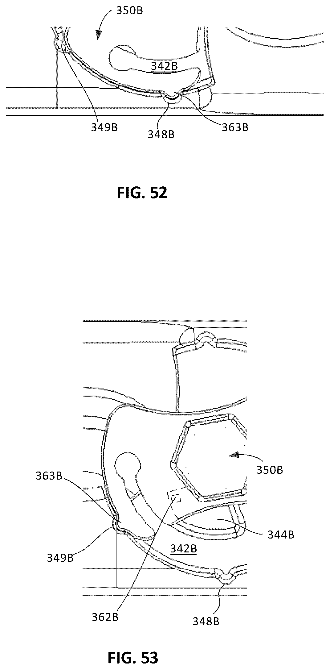 Patent US12303401 Figure 18 – Tritanium AL implants and instrumentation
